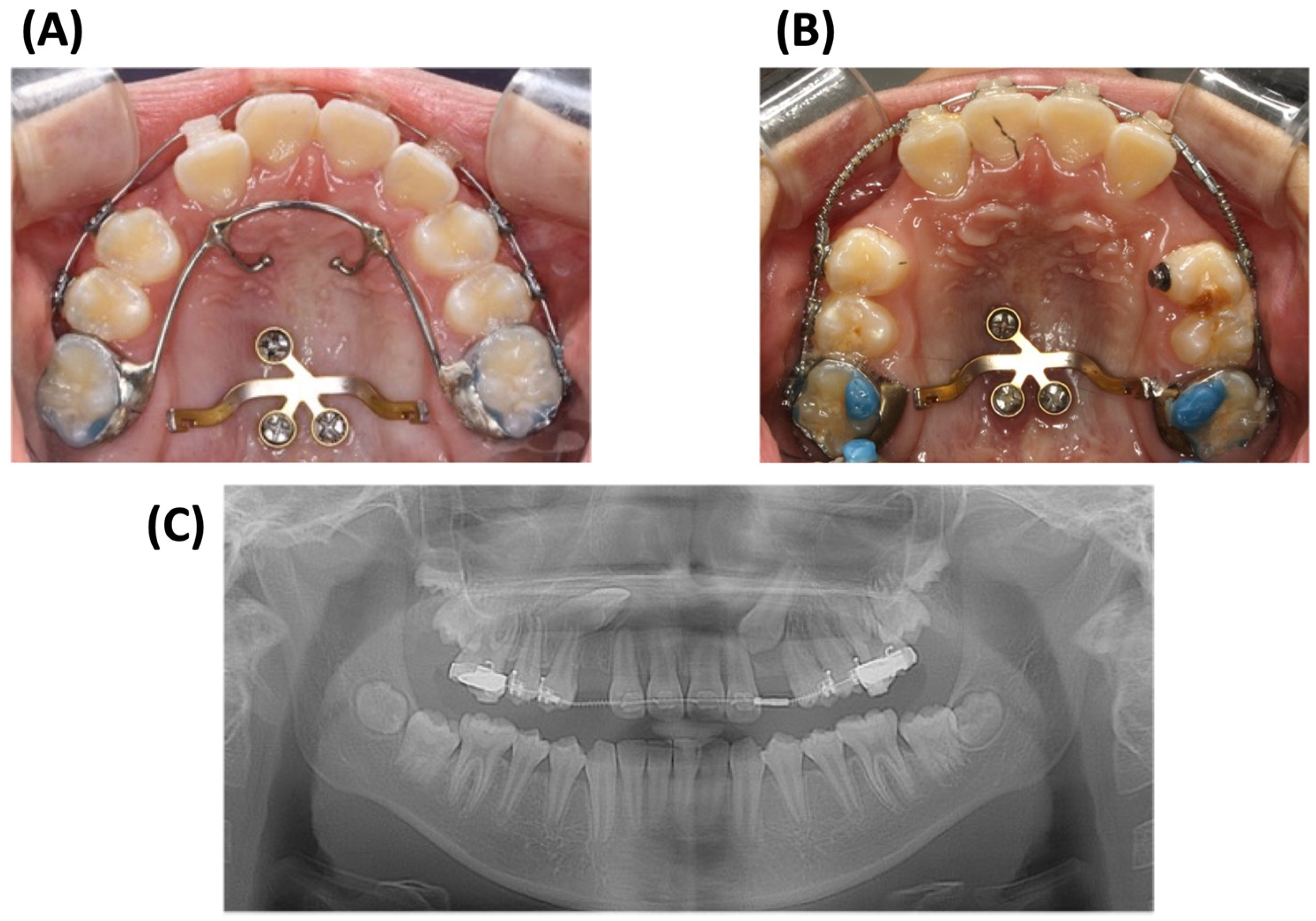 Applsci 13 11665 g004