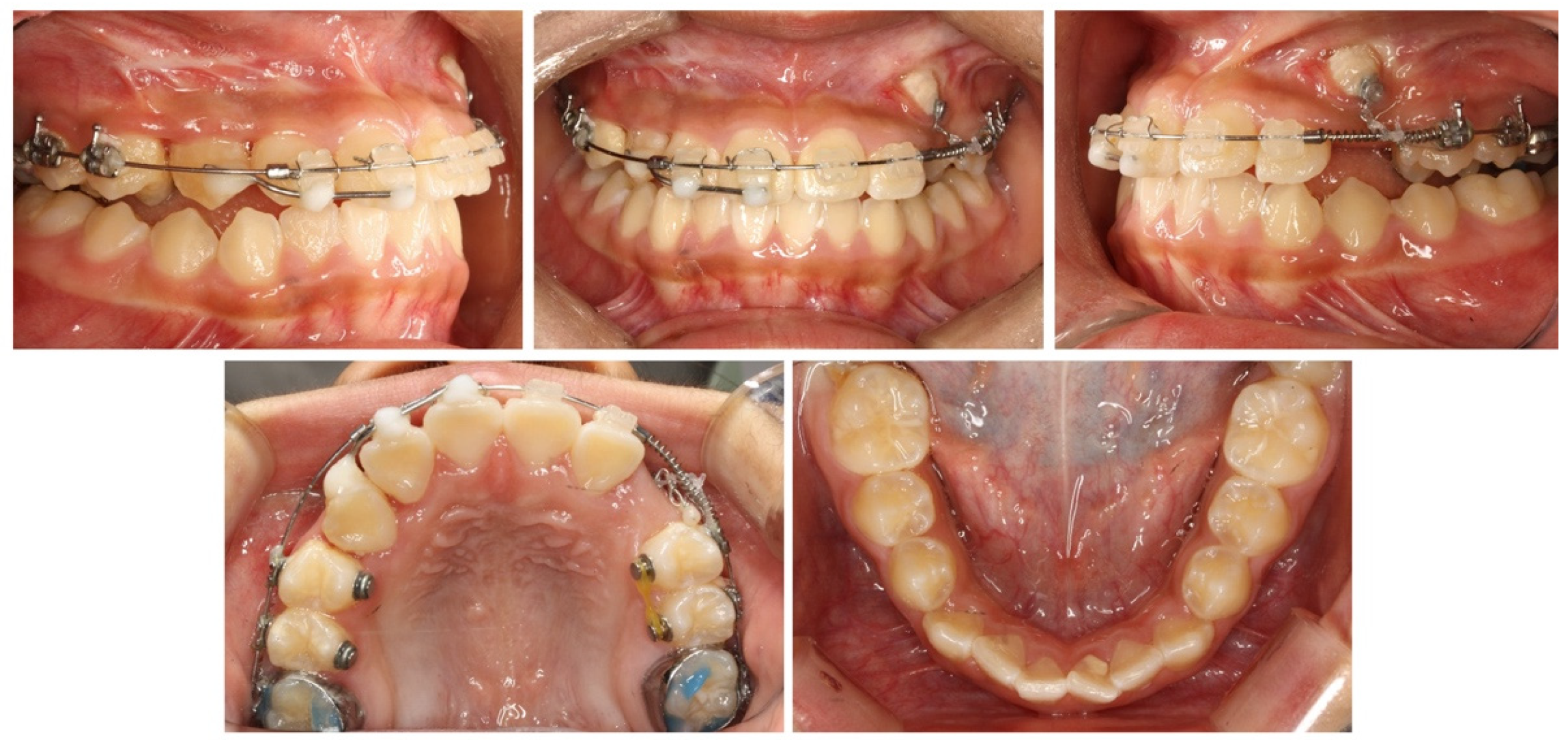 Applsci 13 11665 g006