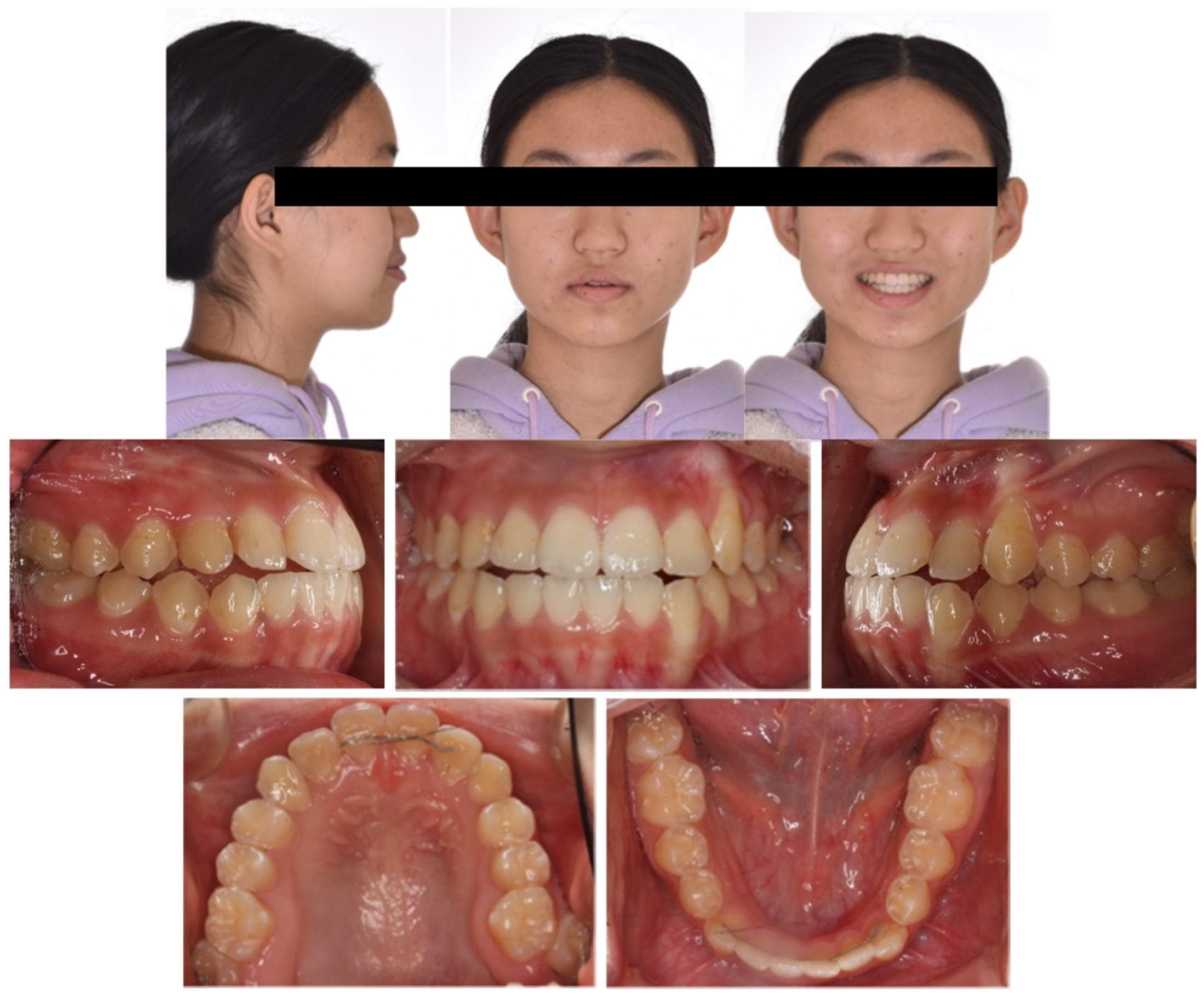 Applsci 13 11665 g011