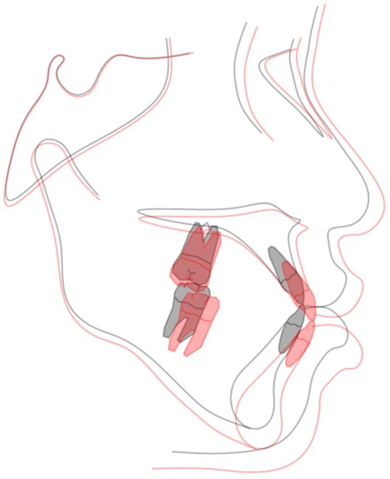 Applsci 13 11665 g016