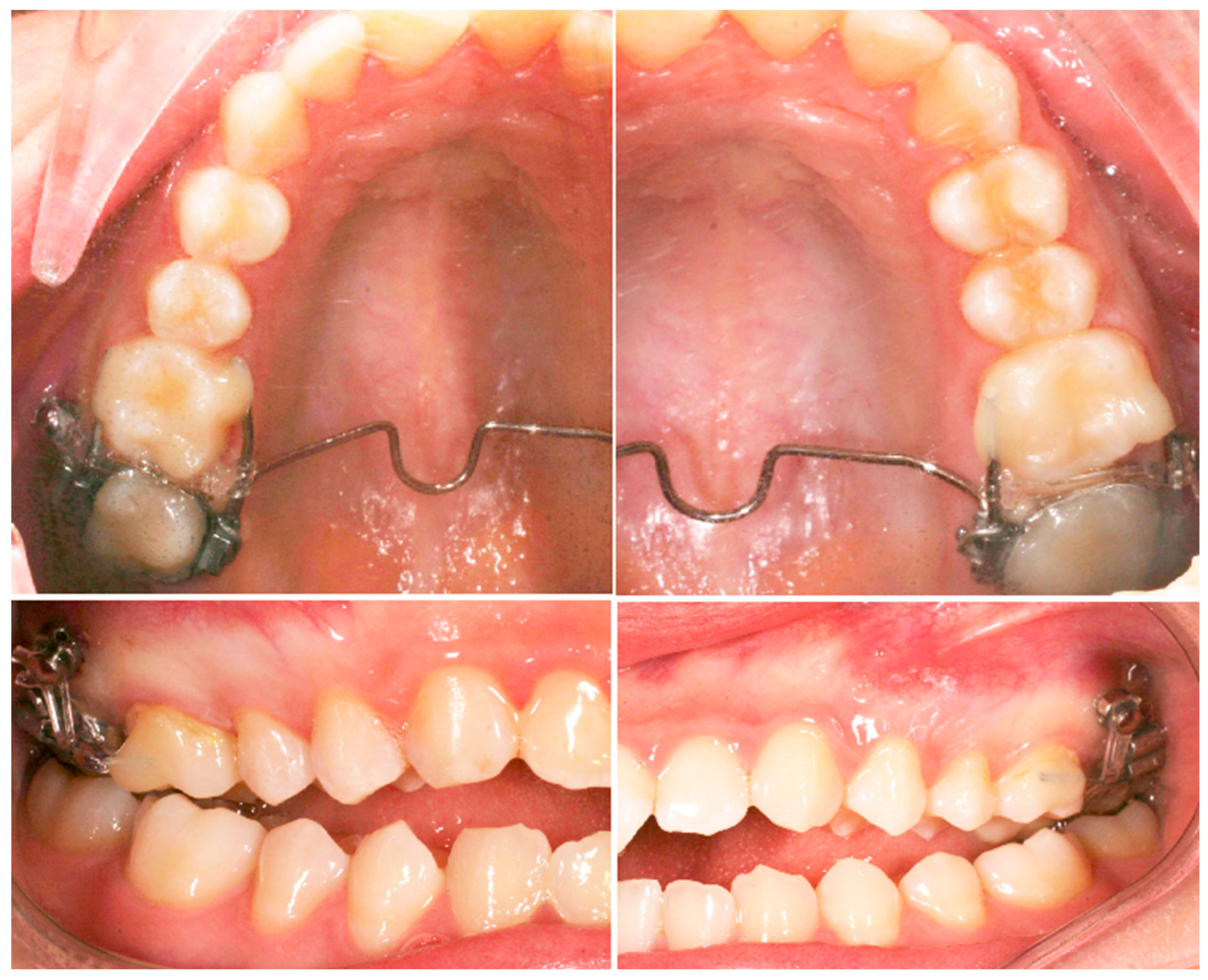 Applsci 13 11696 g003