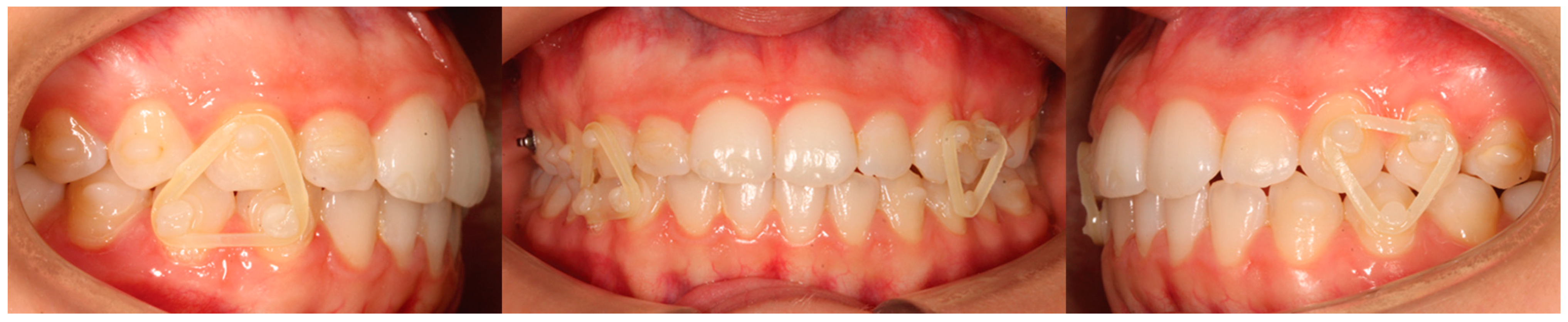 Applsci 13 11696 g006