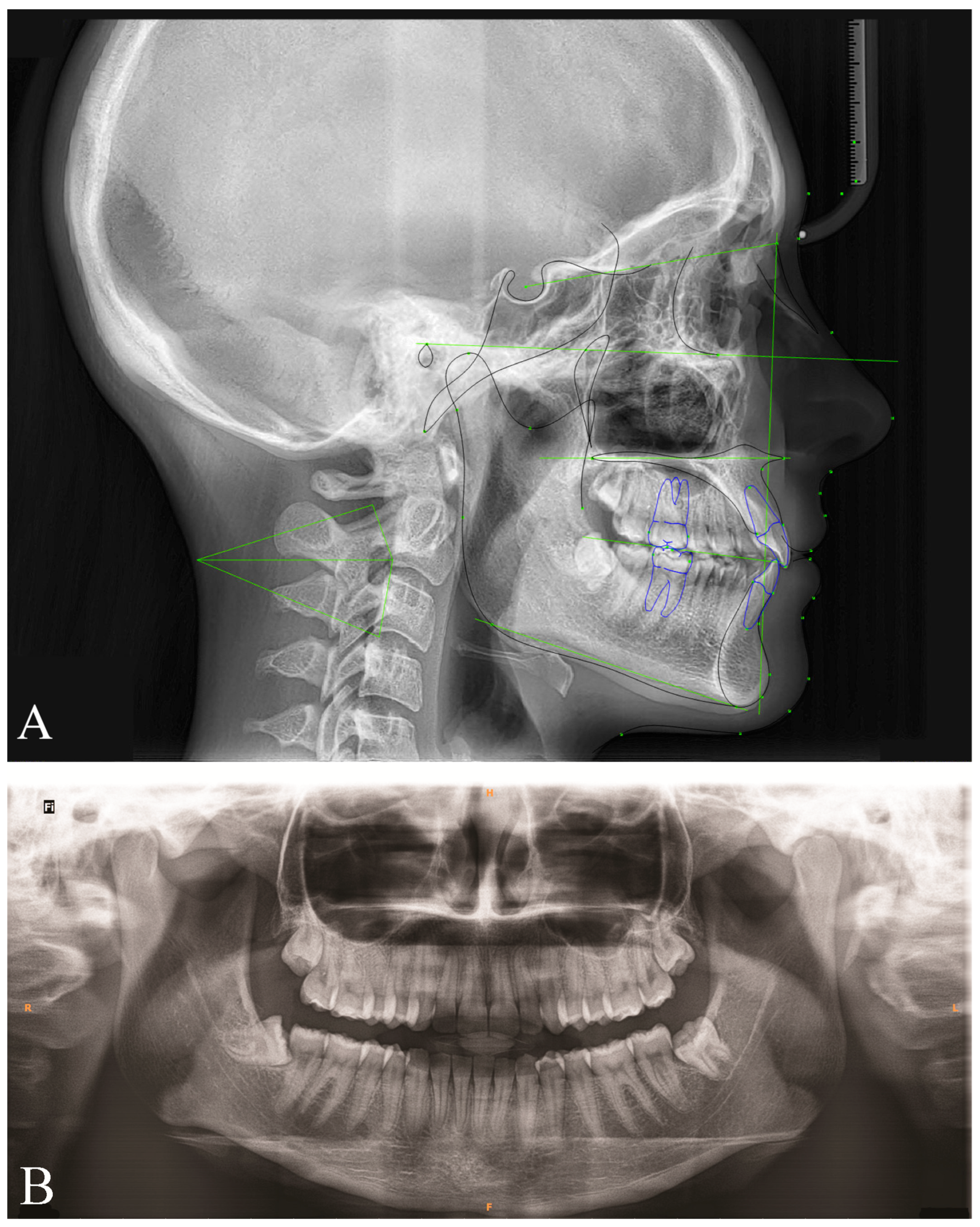 Applsci 13 11696 g009