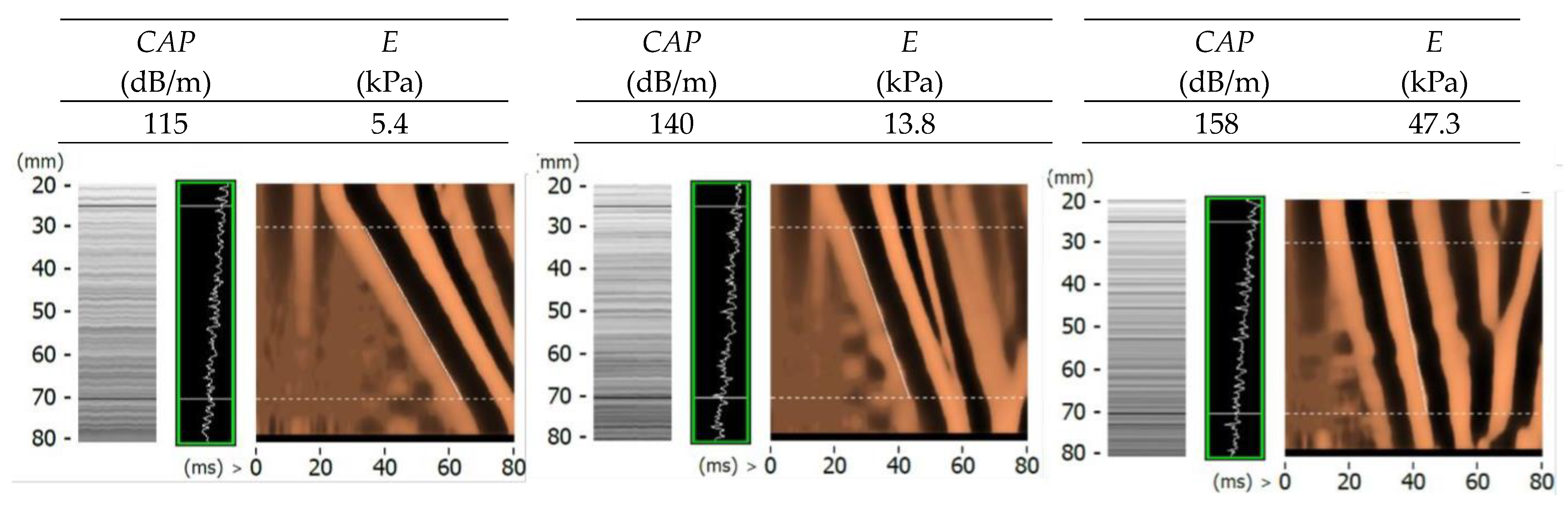 Applsci 13 11843 g017