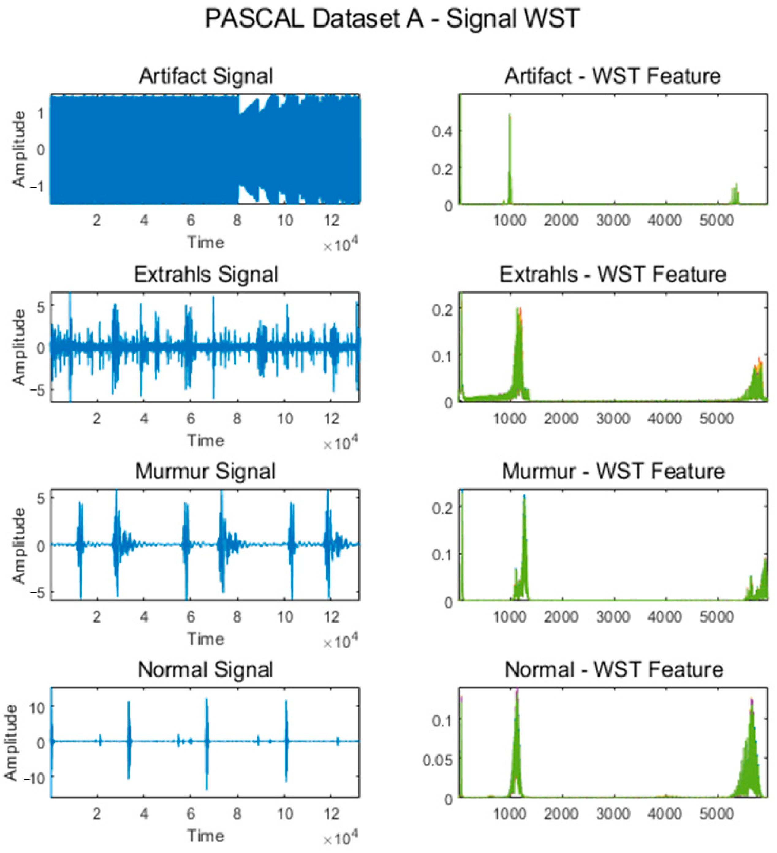 Applied Sciences Free FullText Heart Sound Classification Using