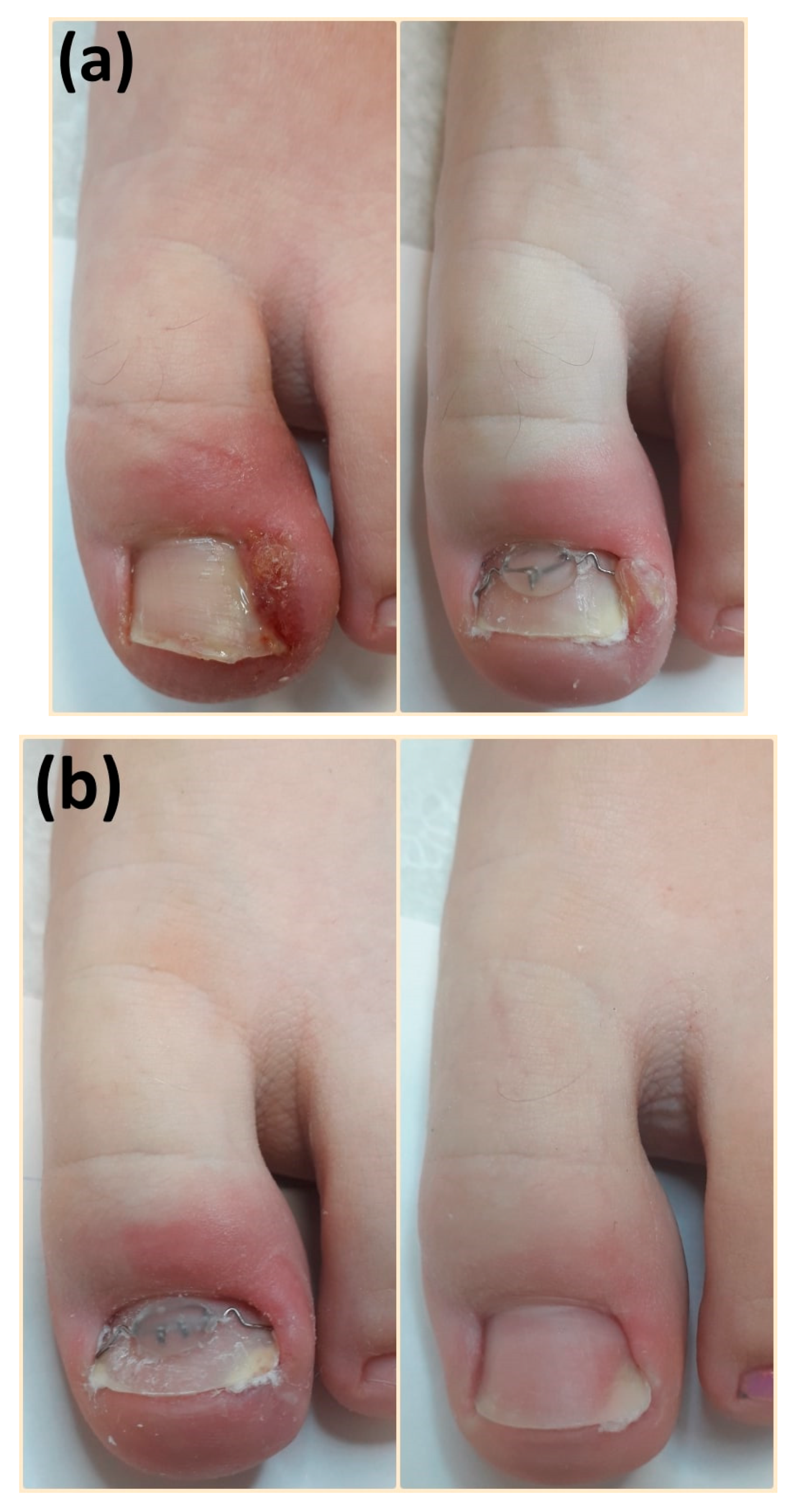 Nail changes - clinical review | GPonline