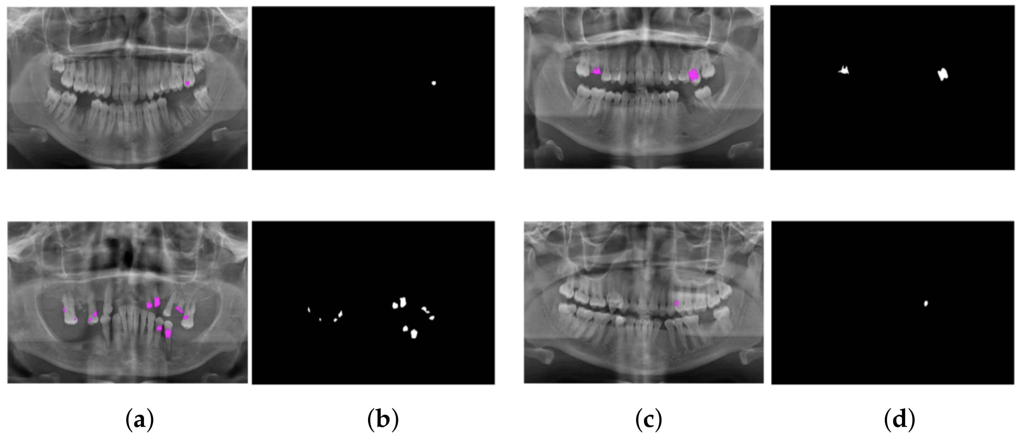 Applied Sciences Free FullText Detection of Cavities from Dental