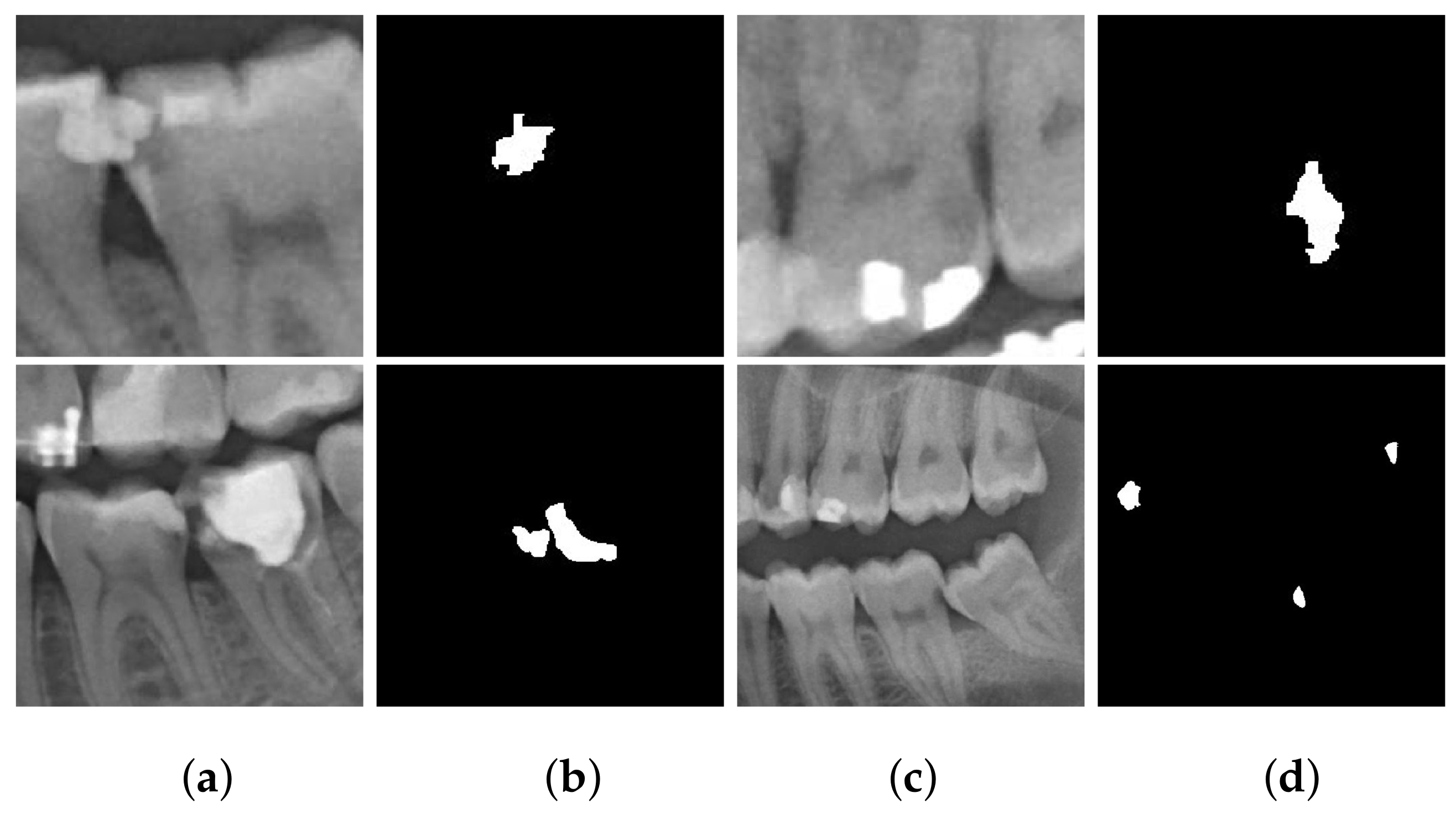 Applied Sciences Free FullText Detection of Cavities from Dental