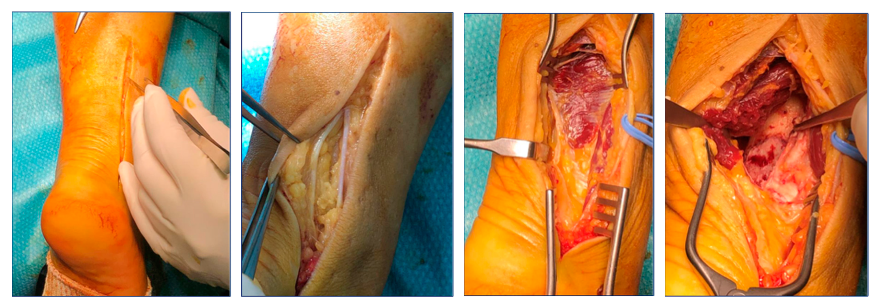 Applsci 14 00802 g003 Applsci 14 00802 g003