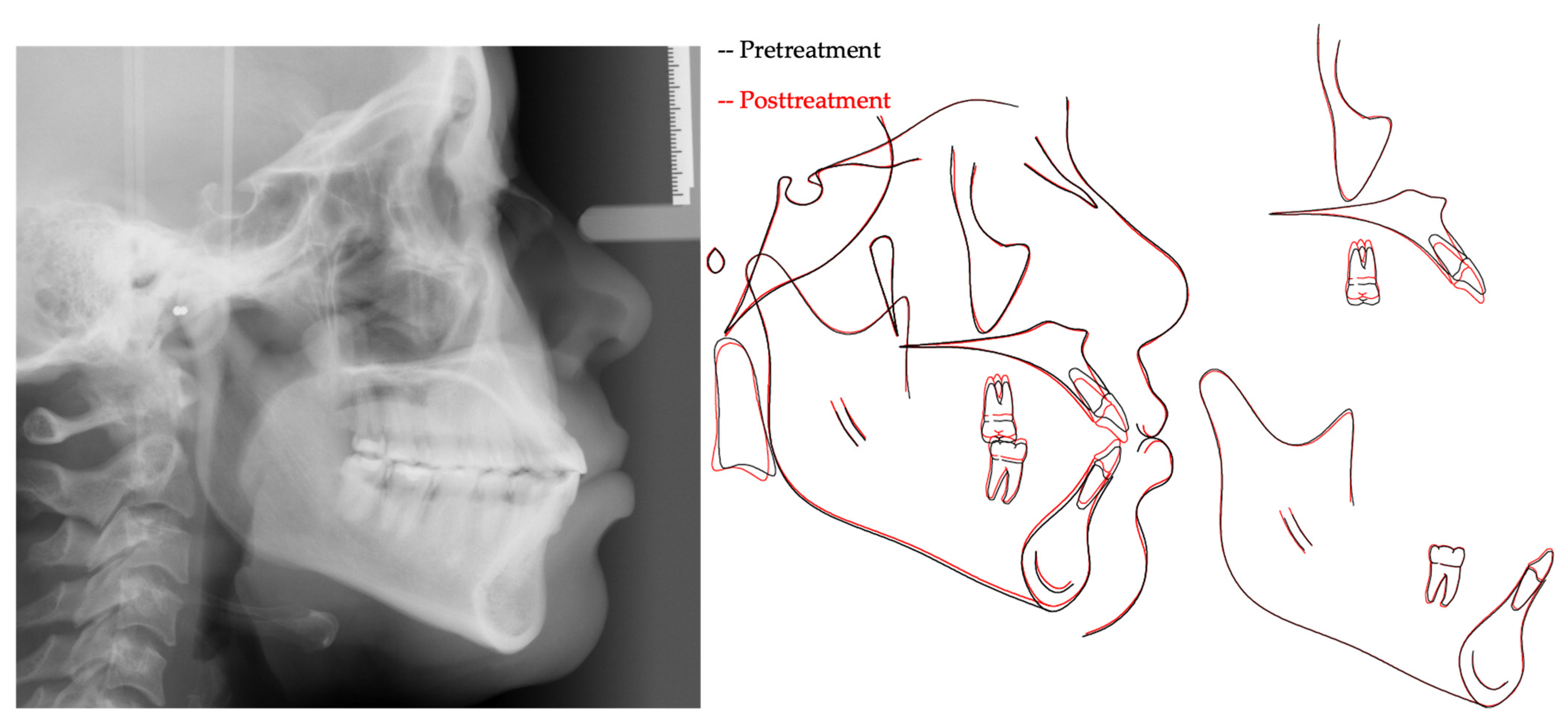 Applsci 14 00811 g006