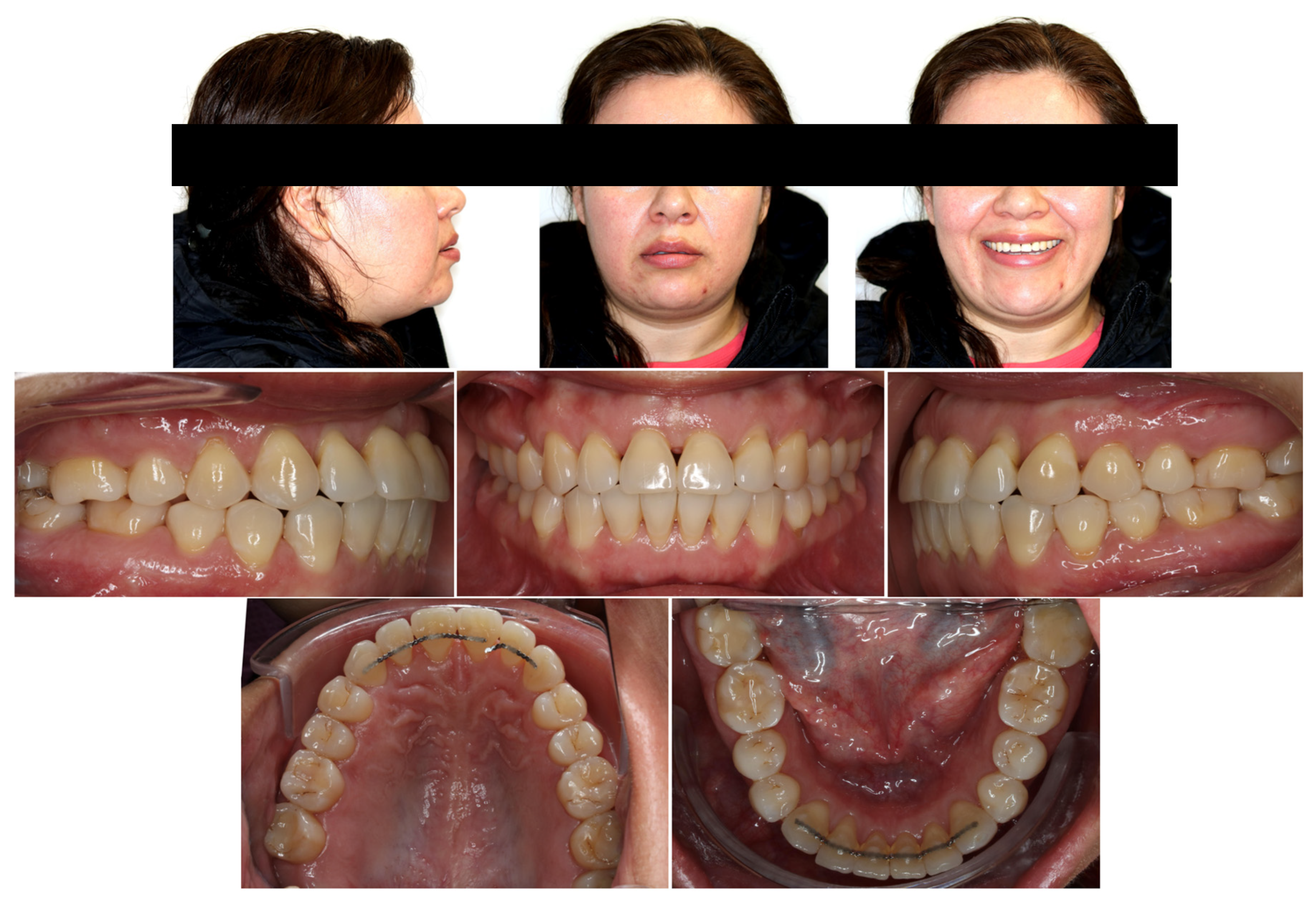 Applsci 14 00811 g008