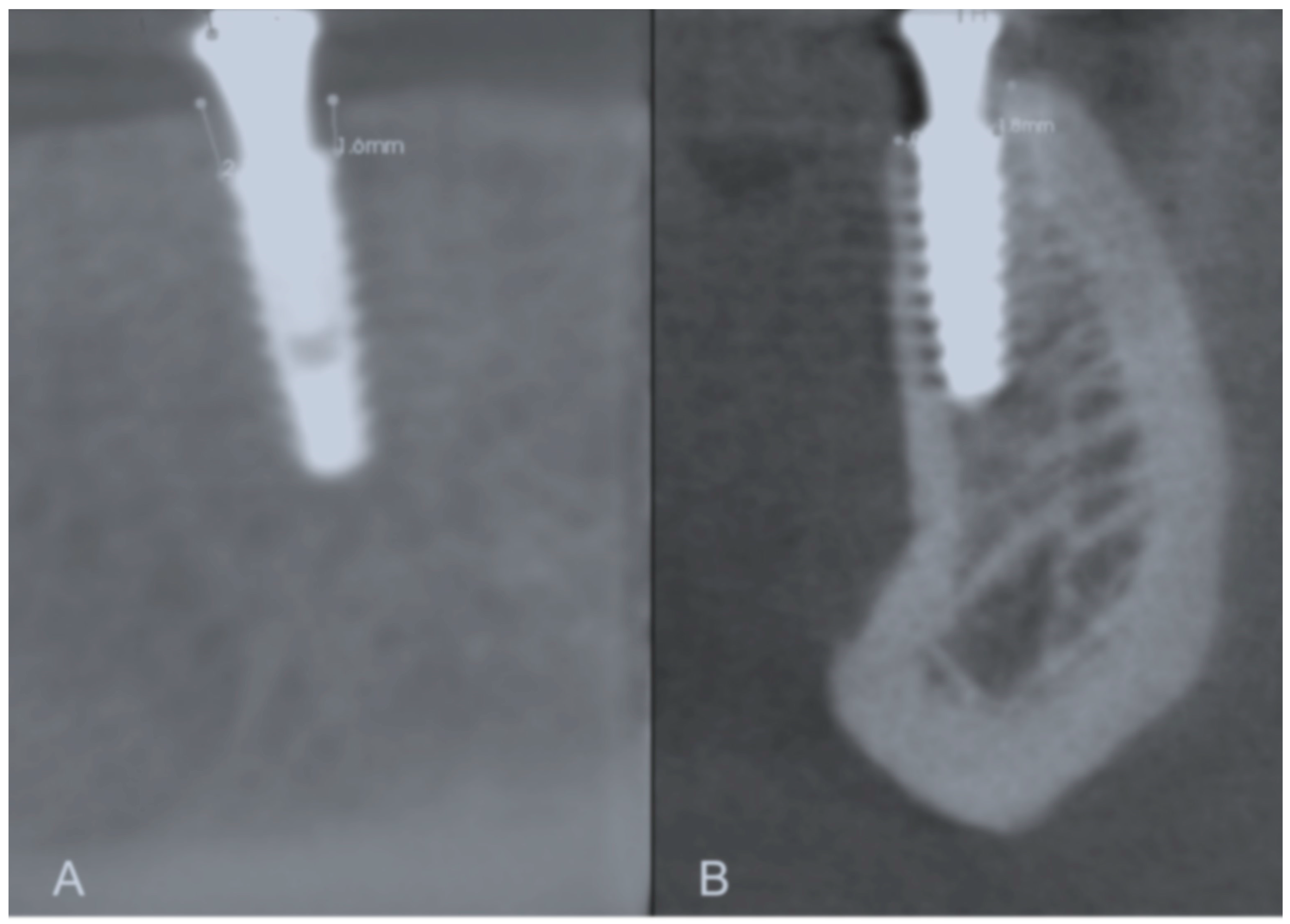 Applsci 14 01026 g003 Applsci 14 01026 g003