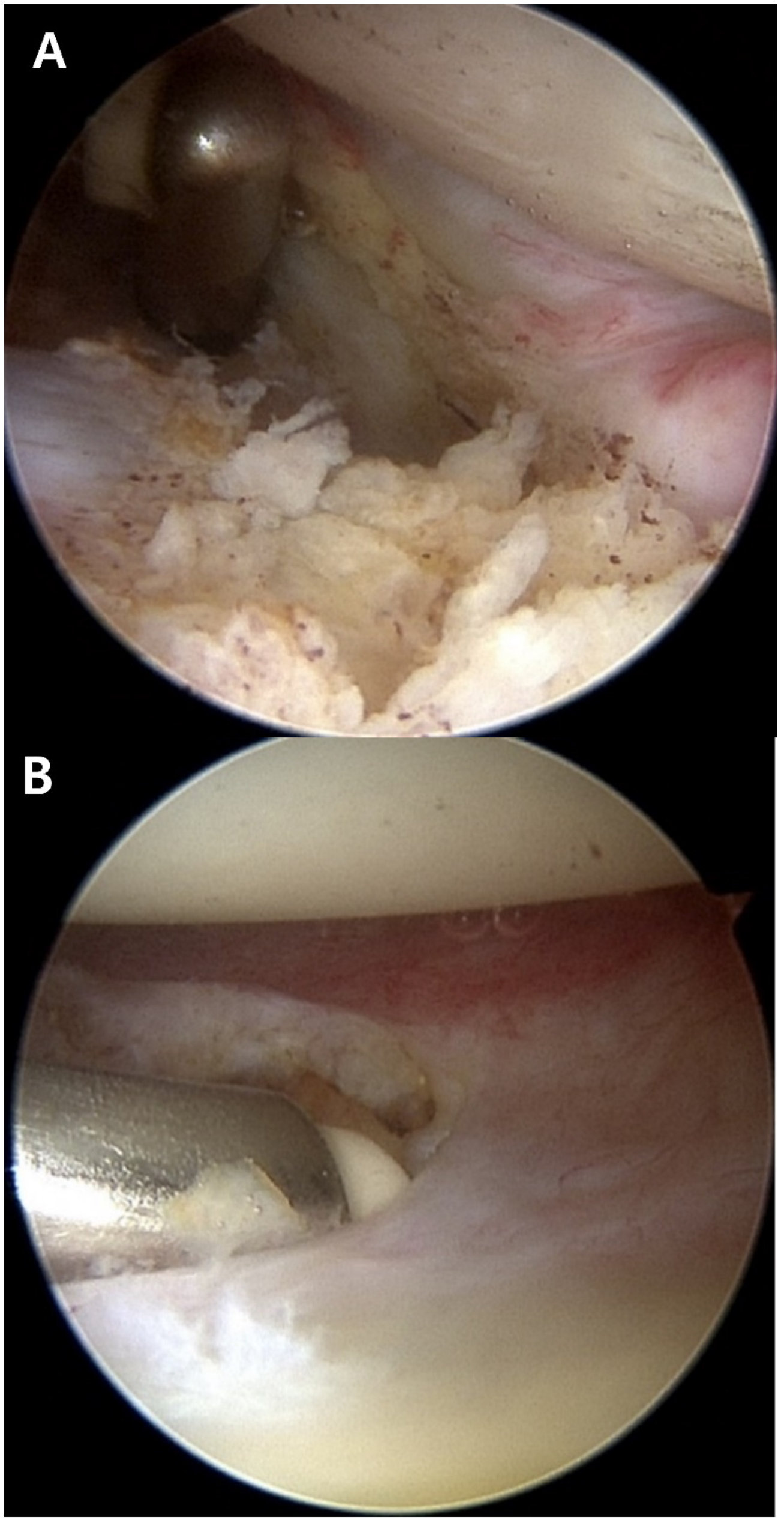 Applsci 14 01252 g002a