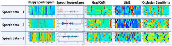 Speech Emotion Recognition Using Deep Learning Transfer Models and ...
