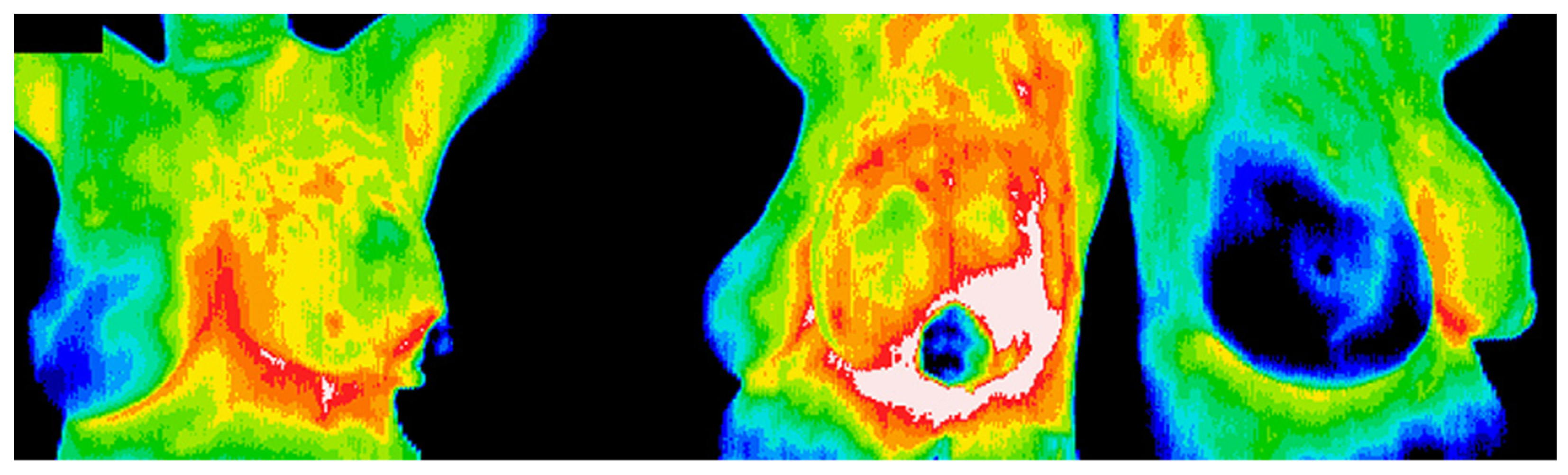 Applsci 14 01603 g005