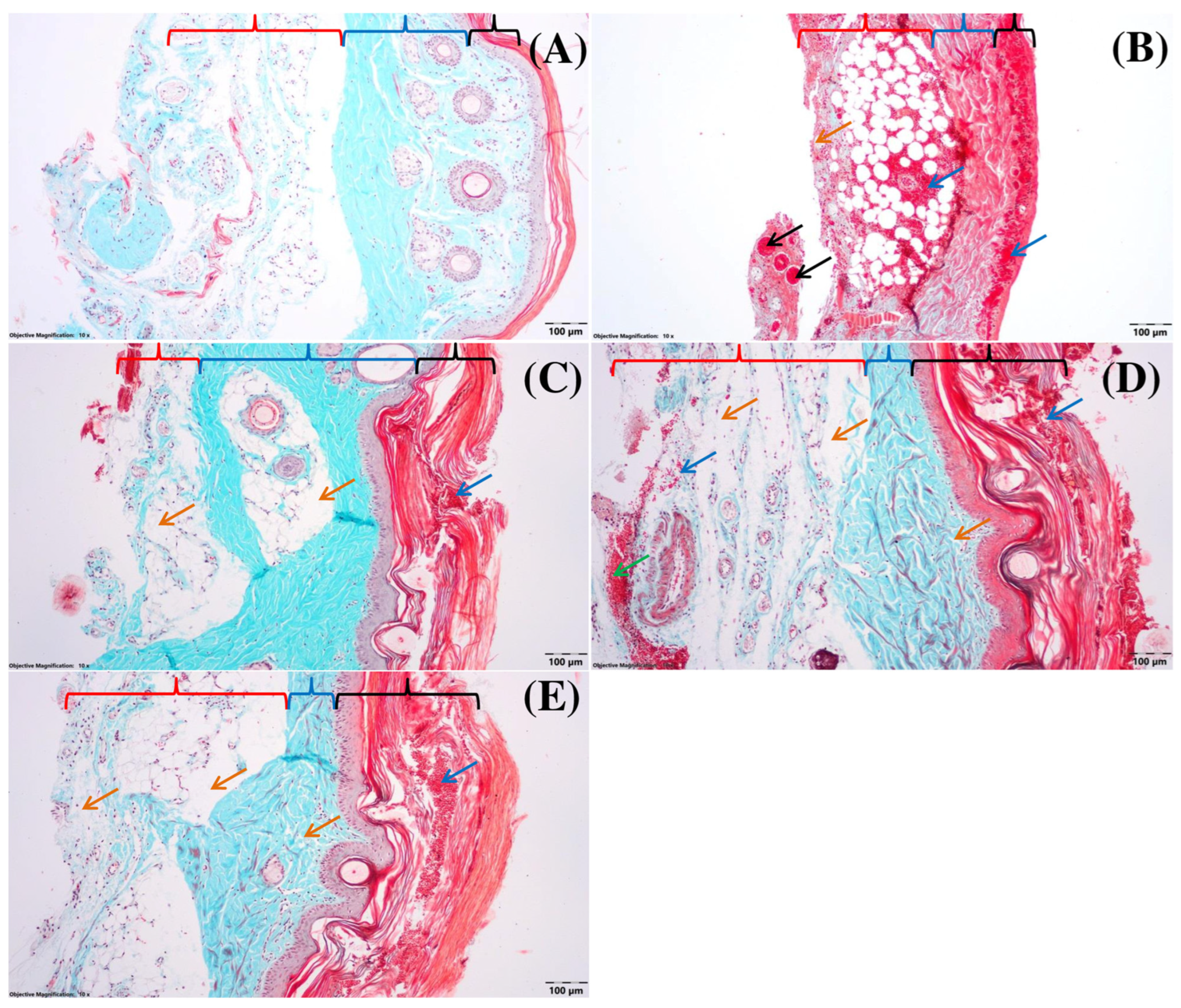 Applsci 14 01852 g006