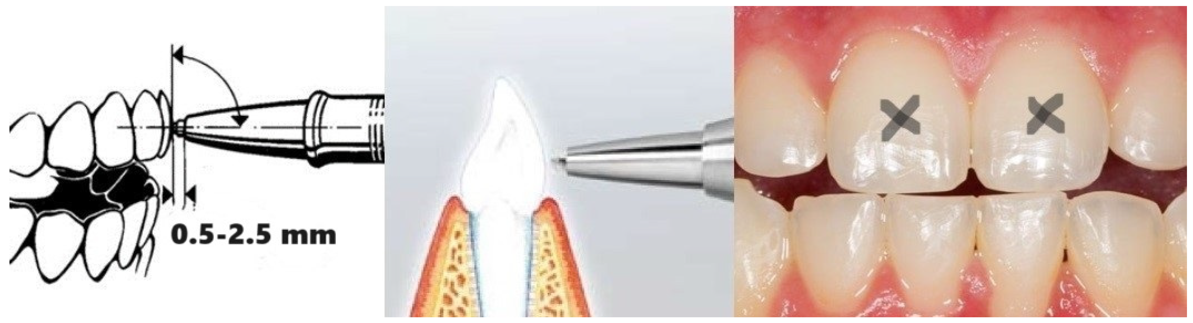 Applsci 14 01860 g003