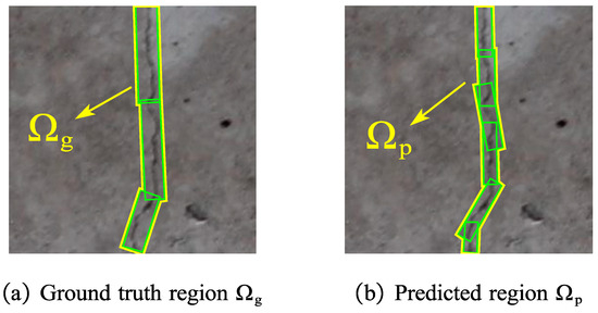 ccナチュラル Neutrophils and NETs in Pathophysiology and Treatment of