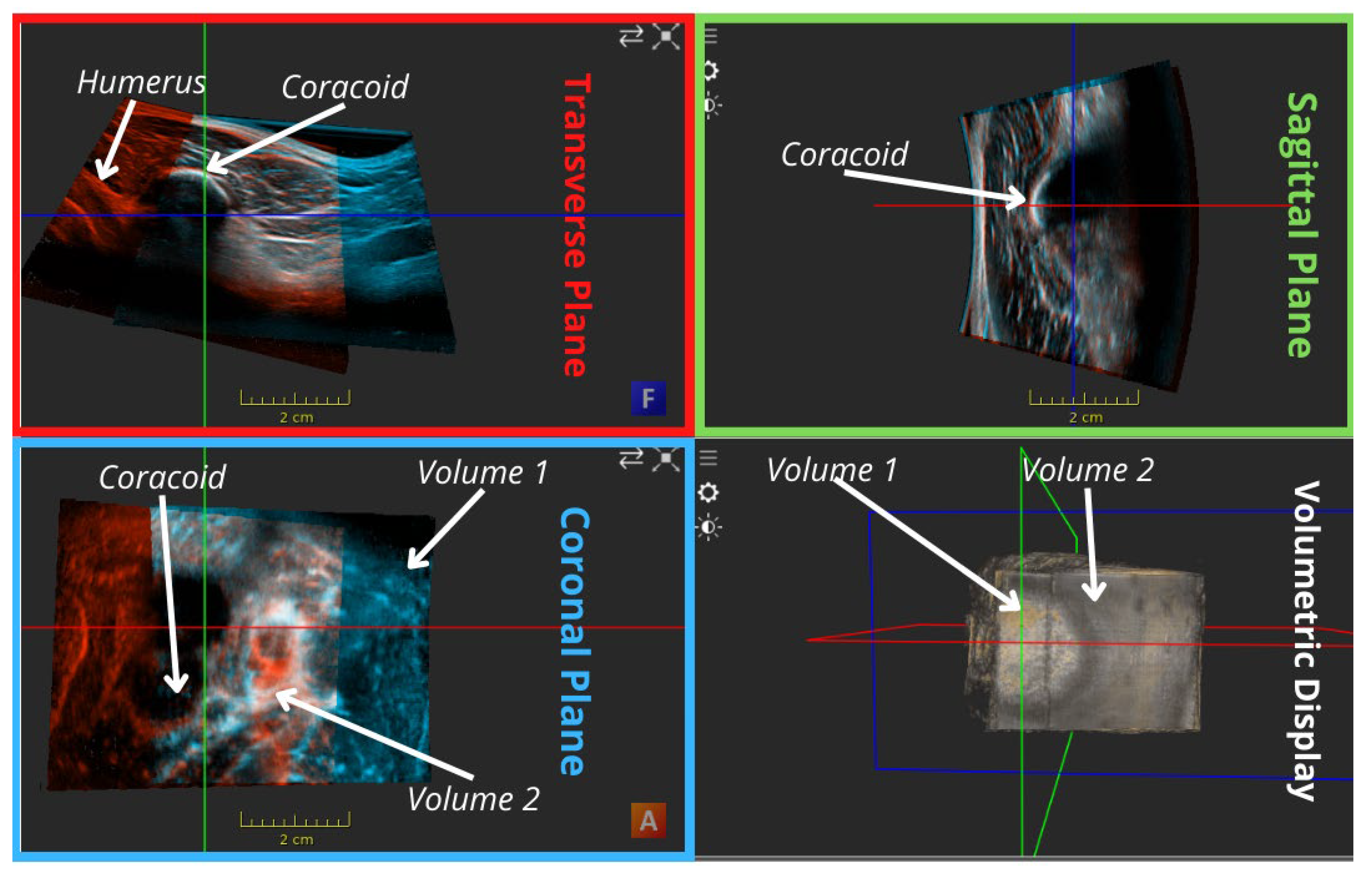 Applsci 14 02152 g002