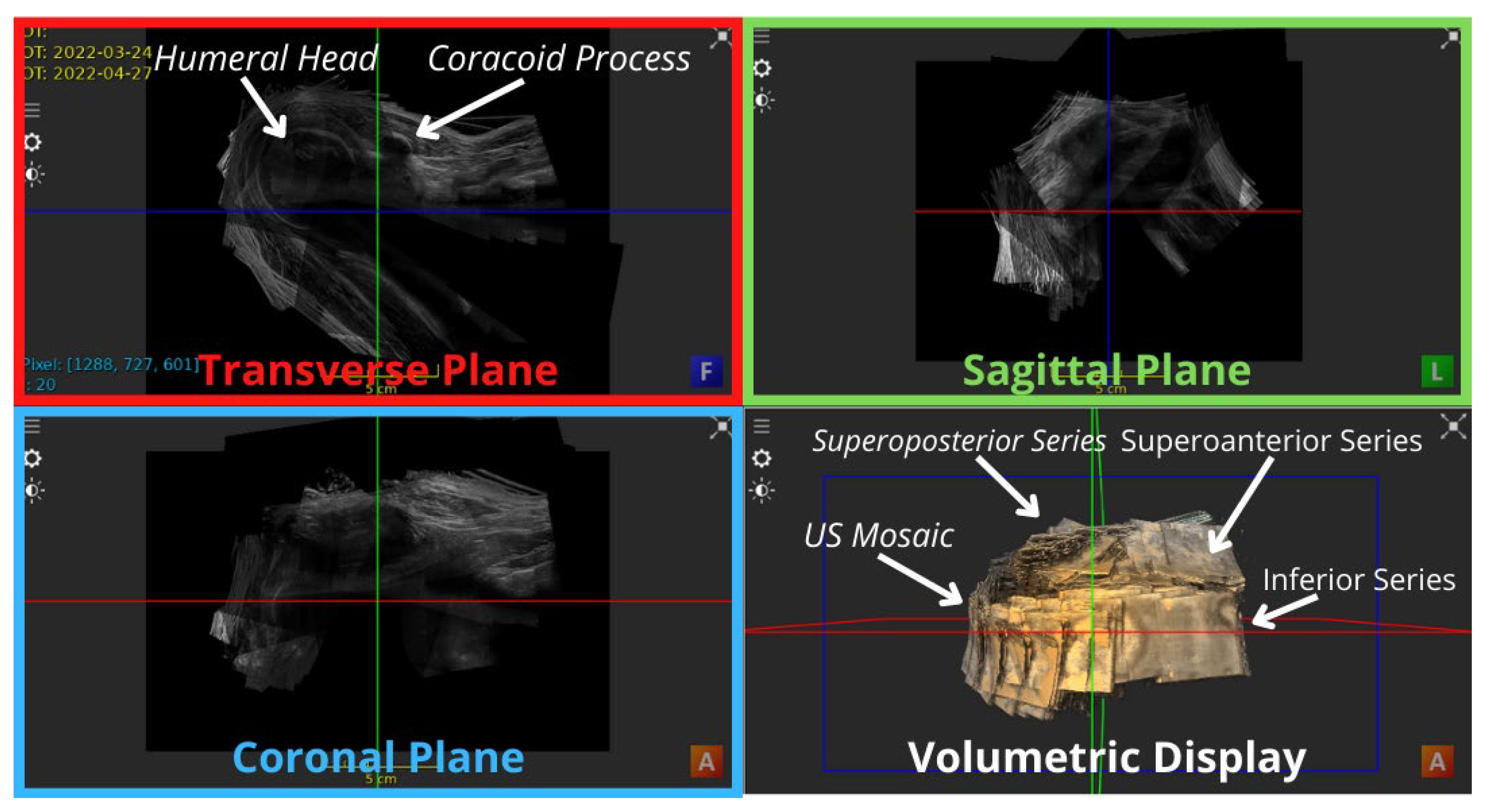 Applsci 14 02152 g003