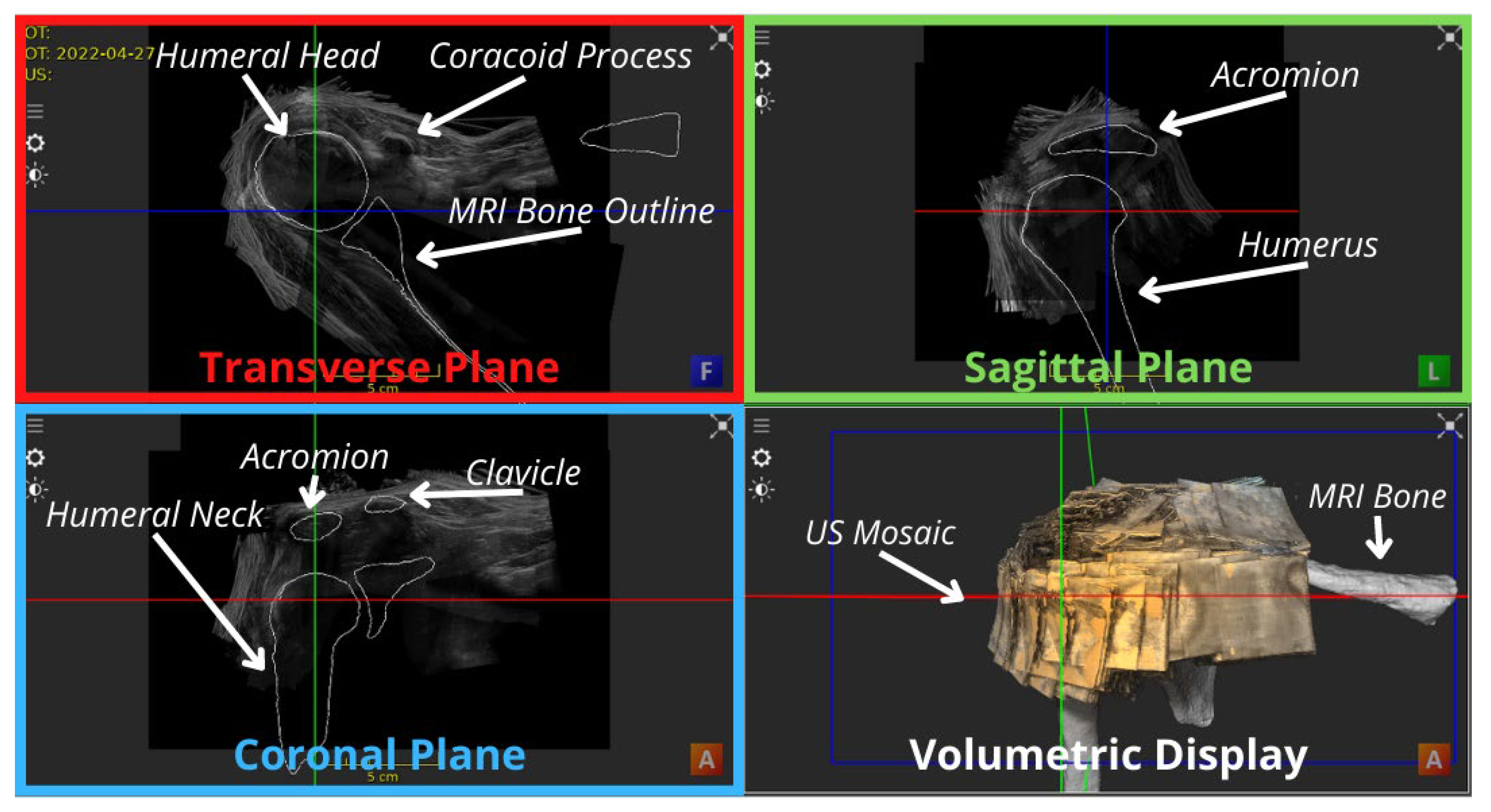 Applsci 14 02152 g004