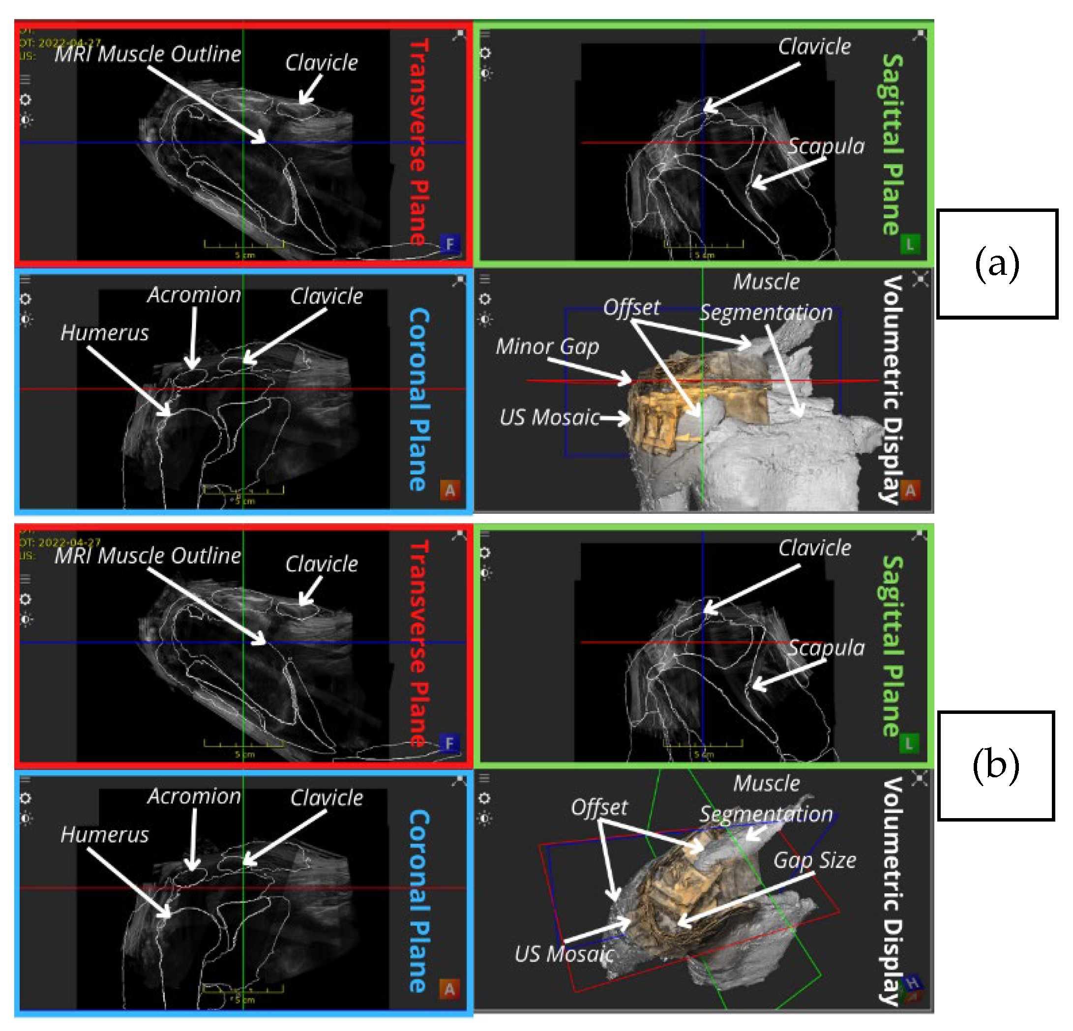 Applsci 14 02152 g005