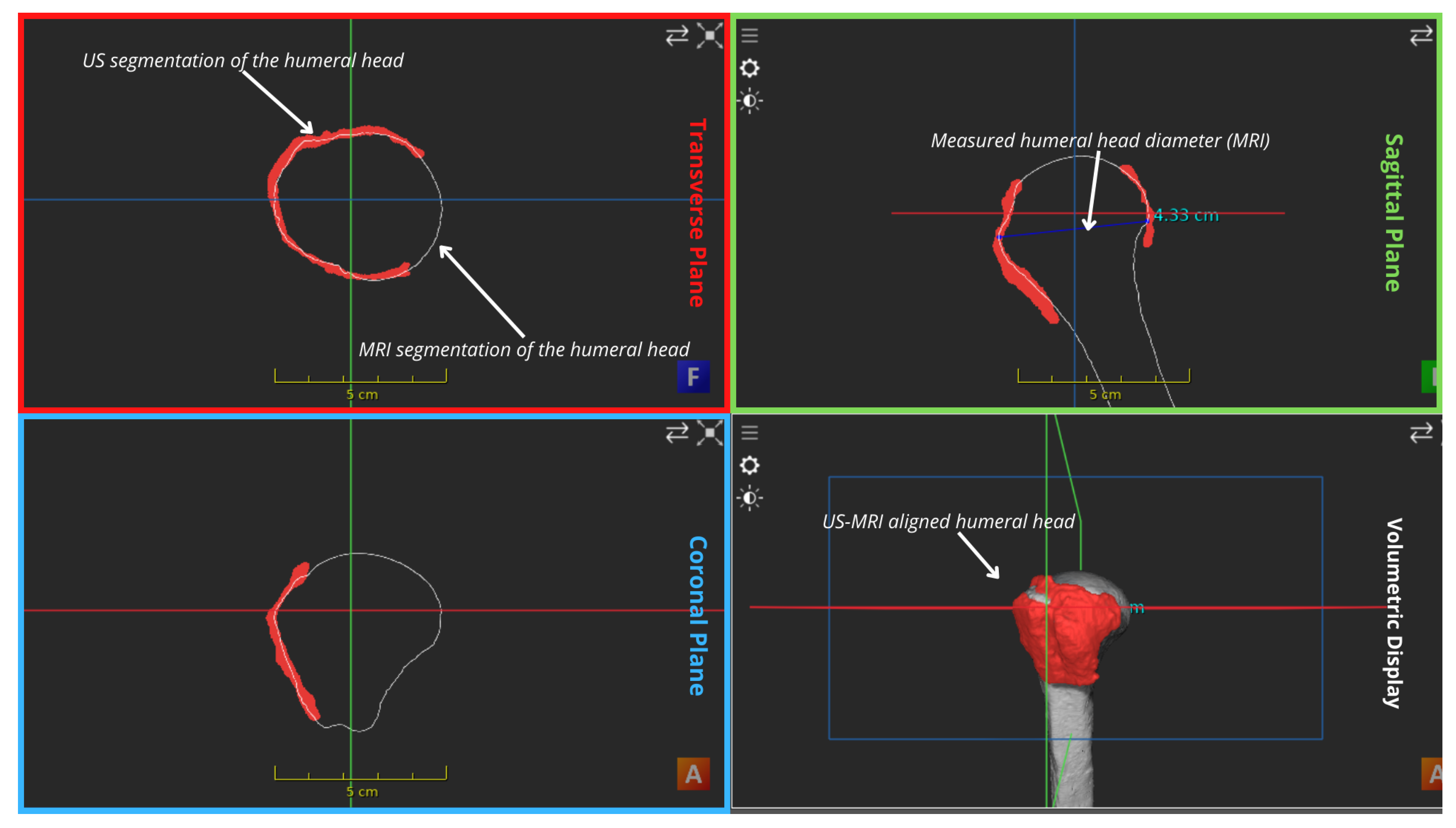 Applsci 14 02152 g006