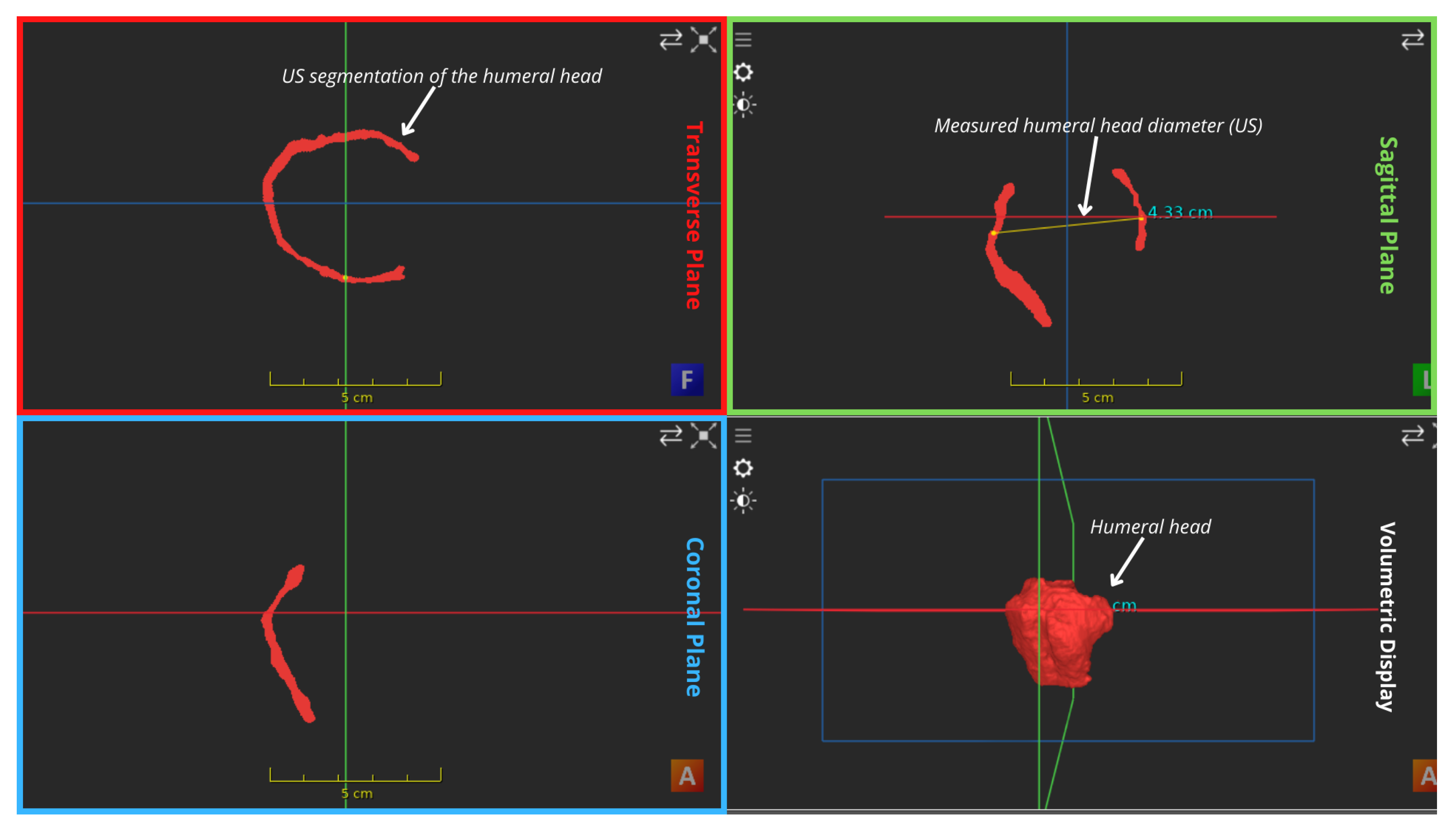 Applsci 14 02152 g007