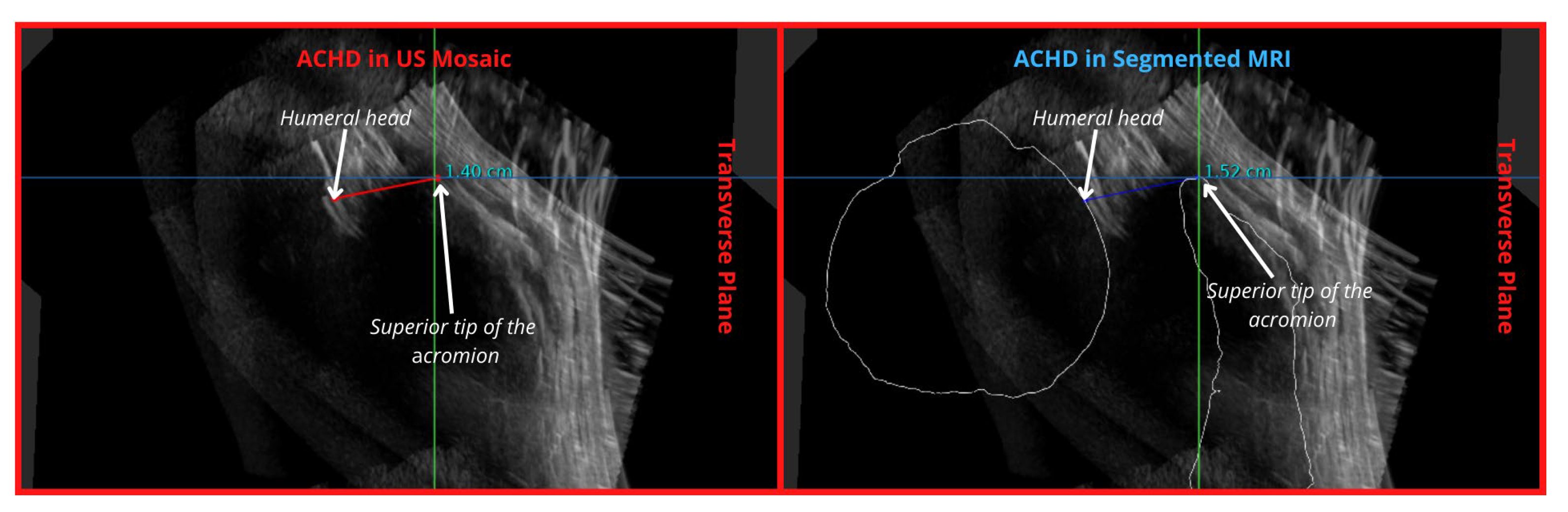 Applsci 14 02152 g008