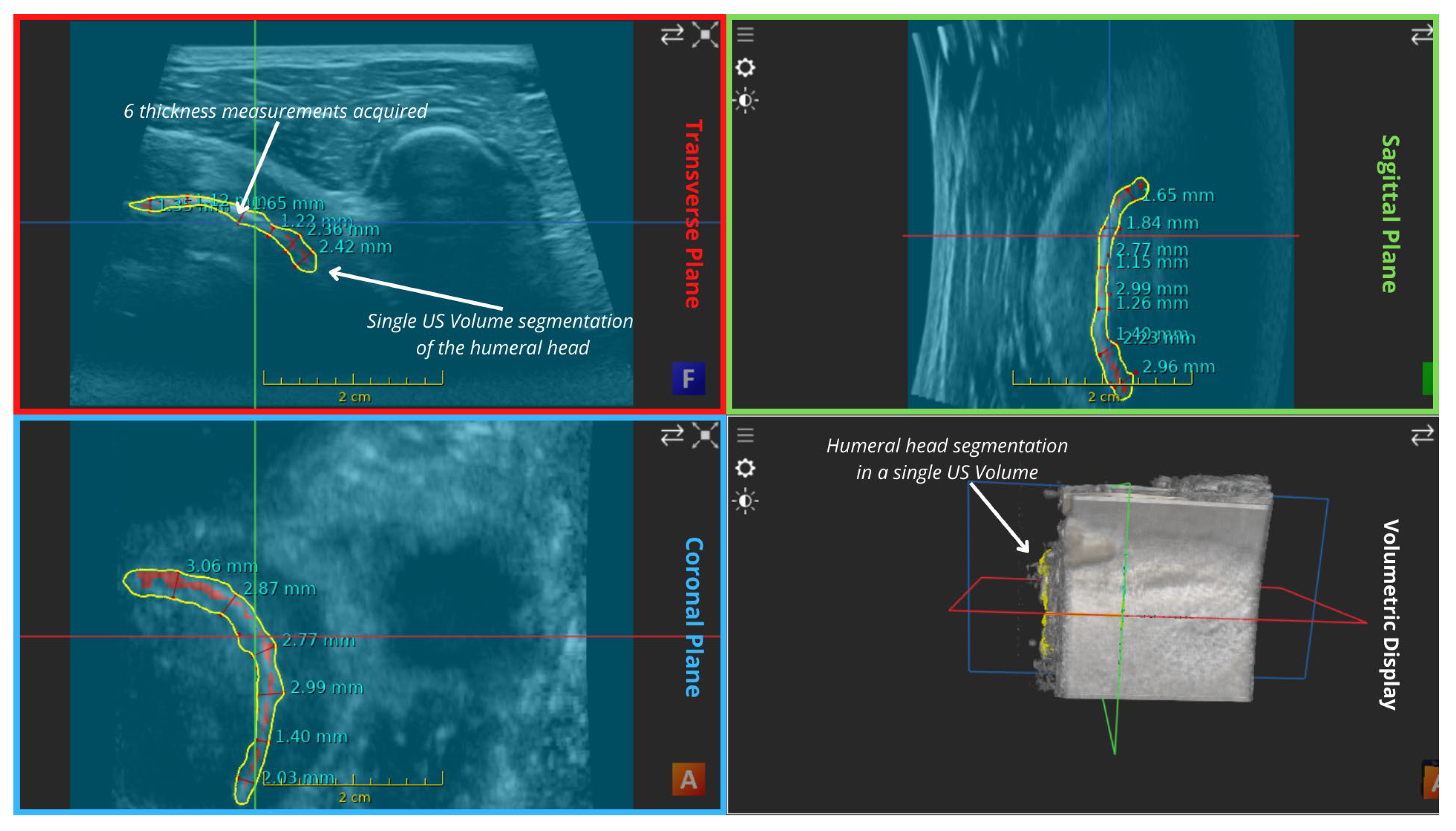 Applsci 14 02152 g0a1