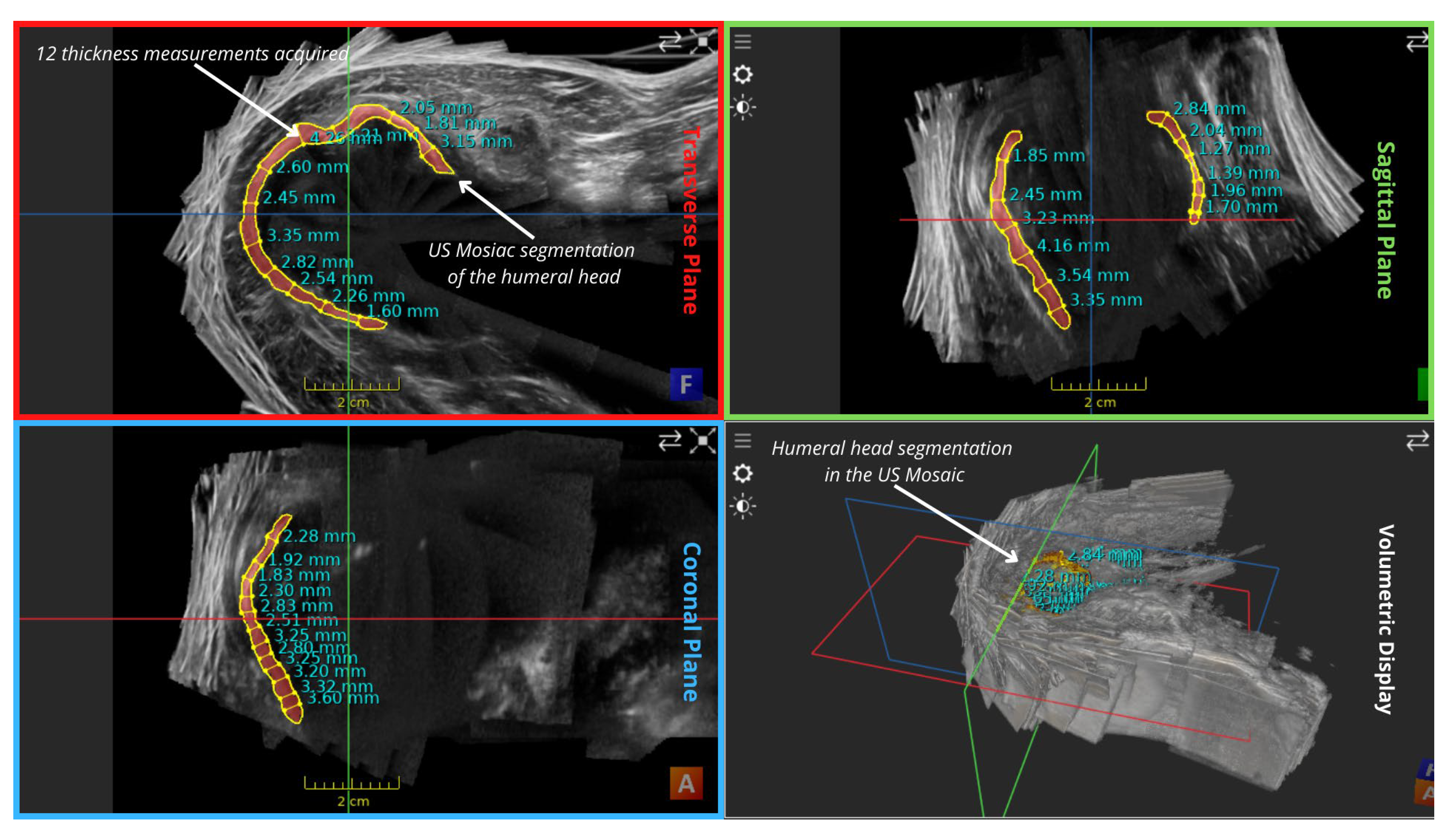 Applsci 14 02152 g0a2