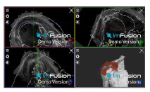 Applsci 14 02152 i024