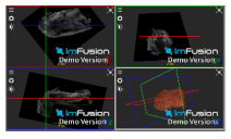 Applsci 14 02152 i028