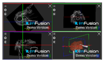 Applsci 14 02152 i038