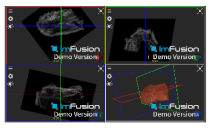 Applsci 14 02152 i043