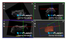 Applsci 14 02152 i046
