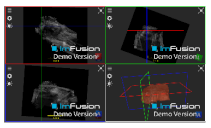 Applsci 14 02152 i049