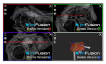 Applsci 14 02152 i056