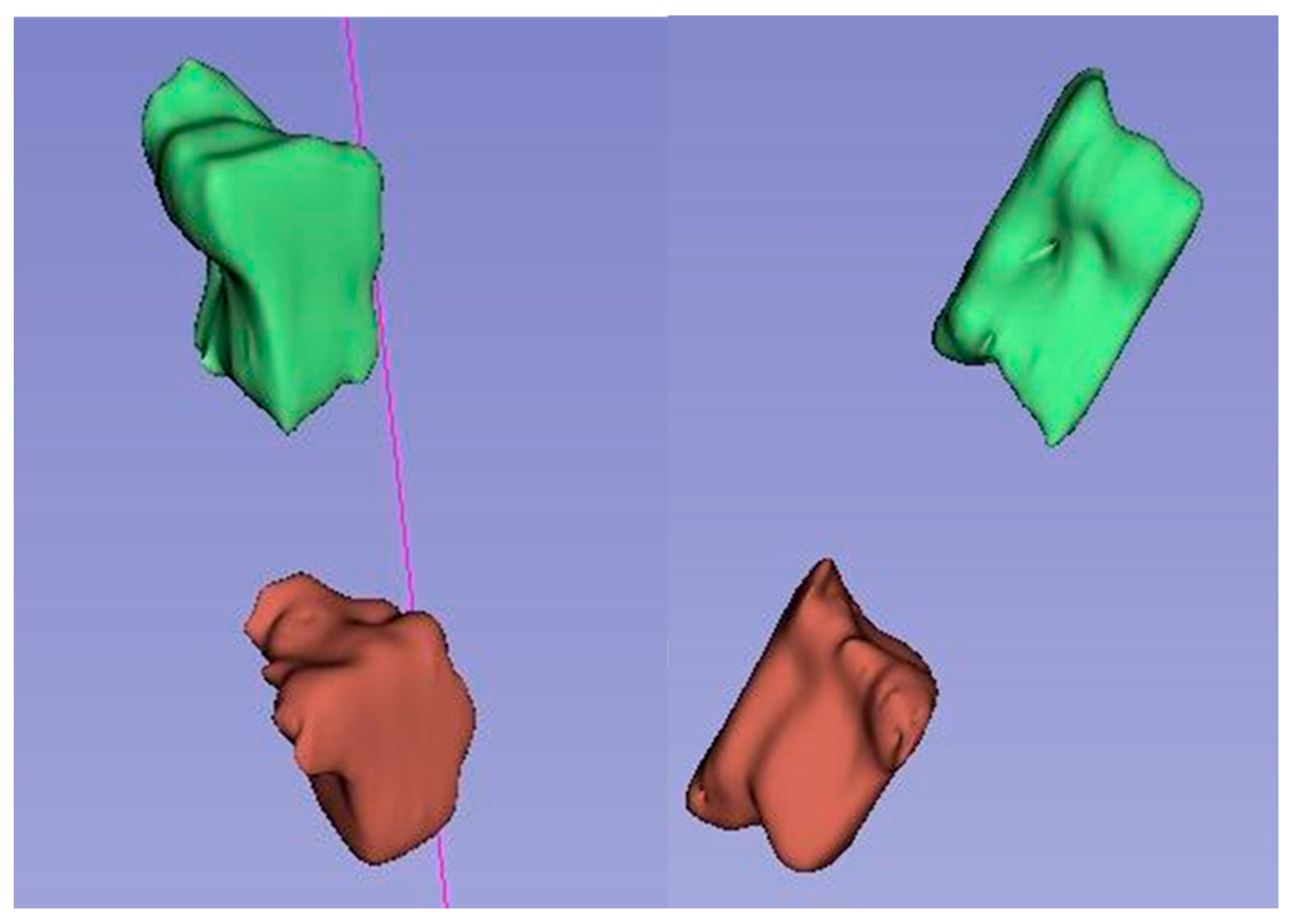 Applsci 14 02263 g006