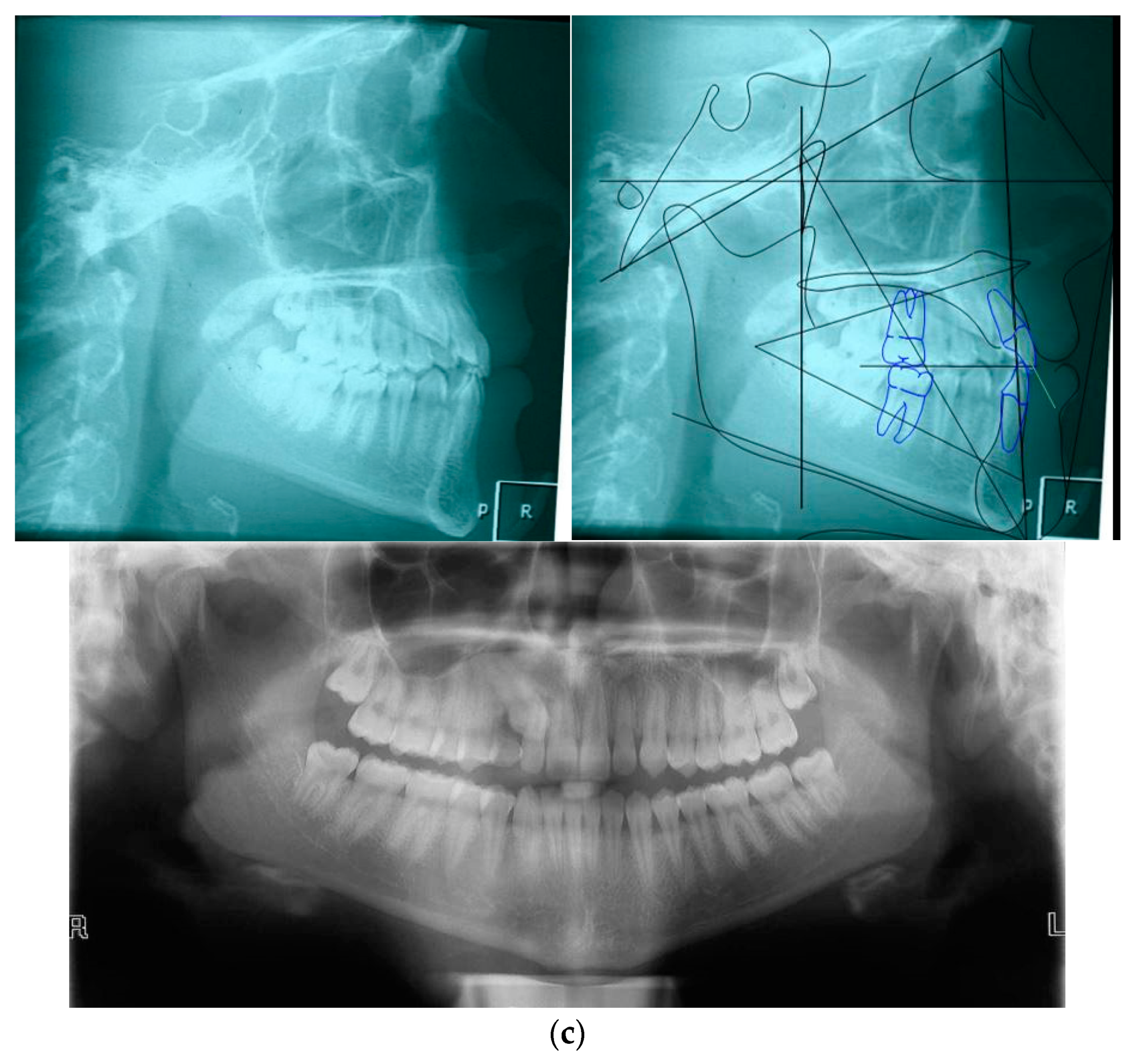 Applsci 14 02308 g002b