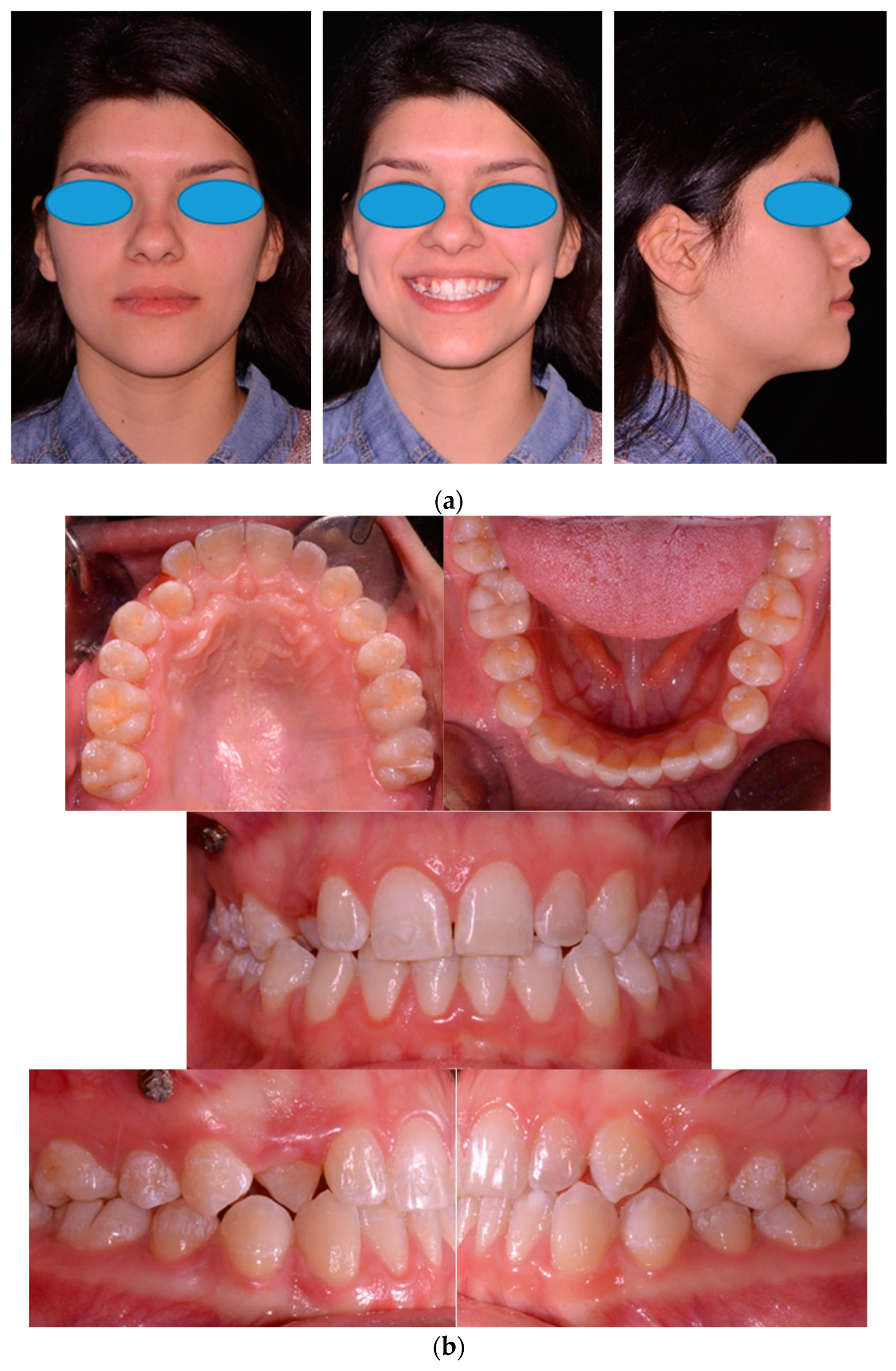 Applsci 14 02308 g004