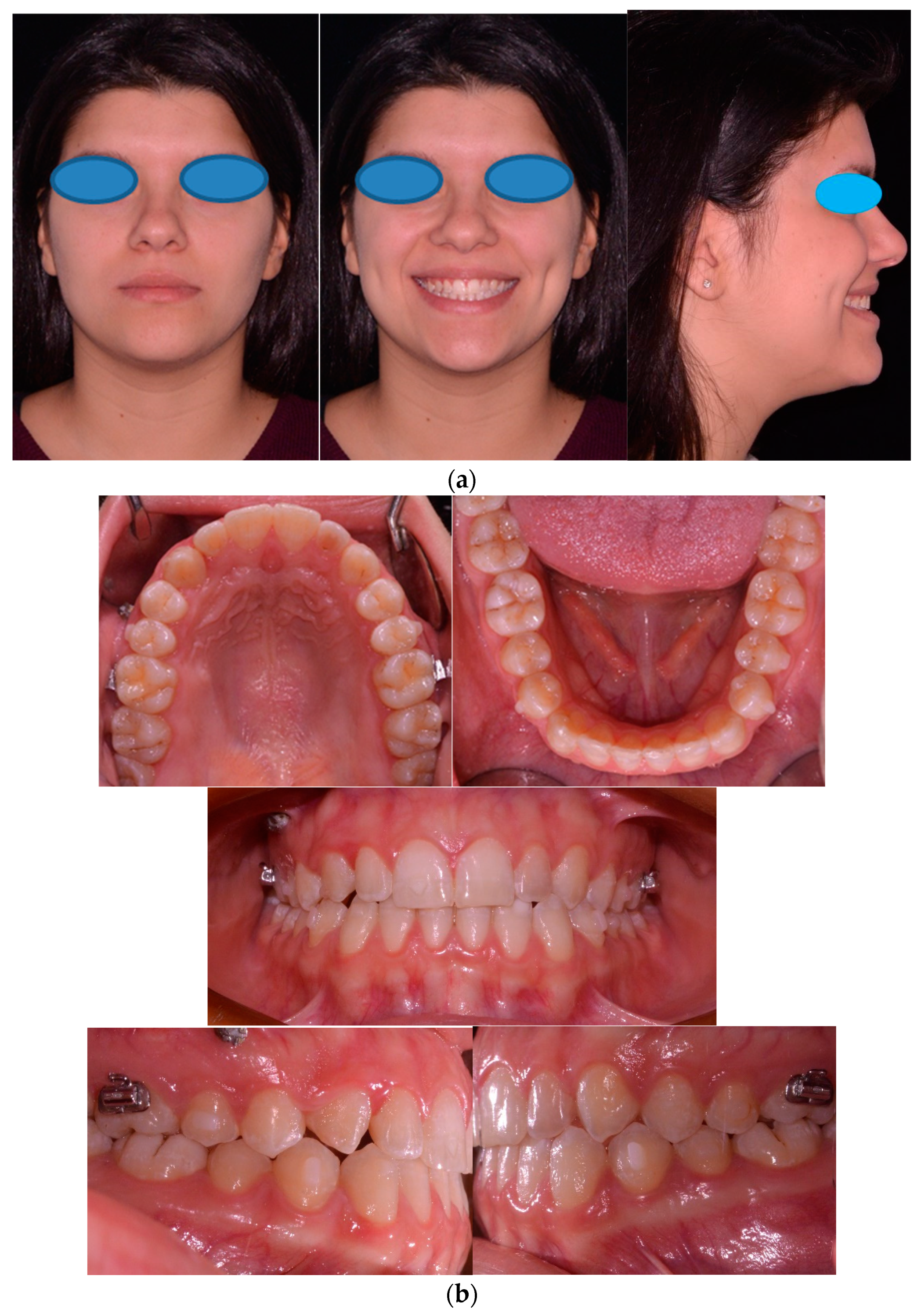 Applsci 14 02308 g010a