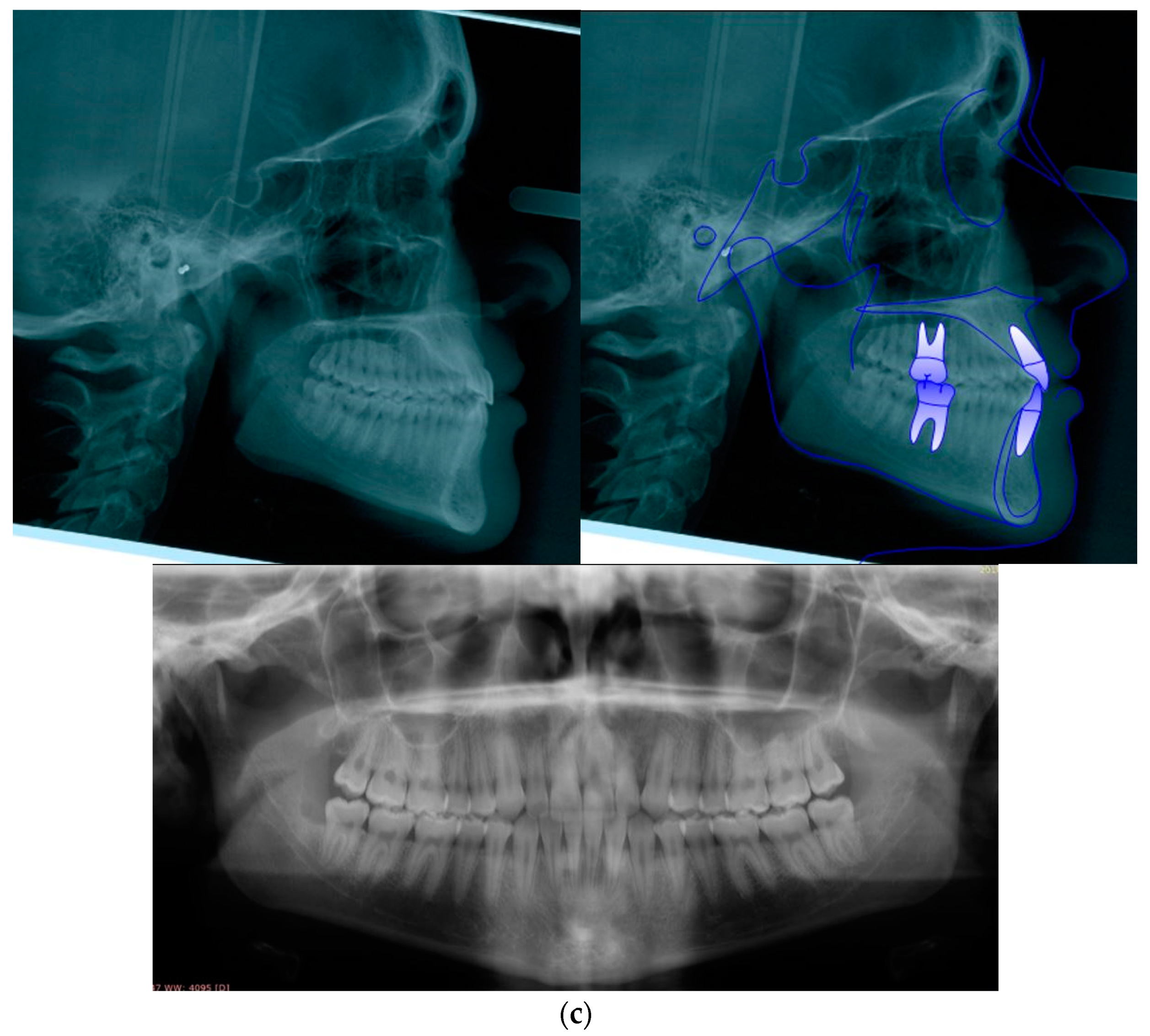 Applsci 14 02308 g010b