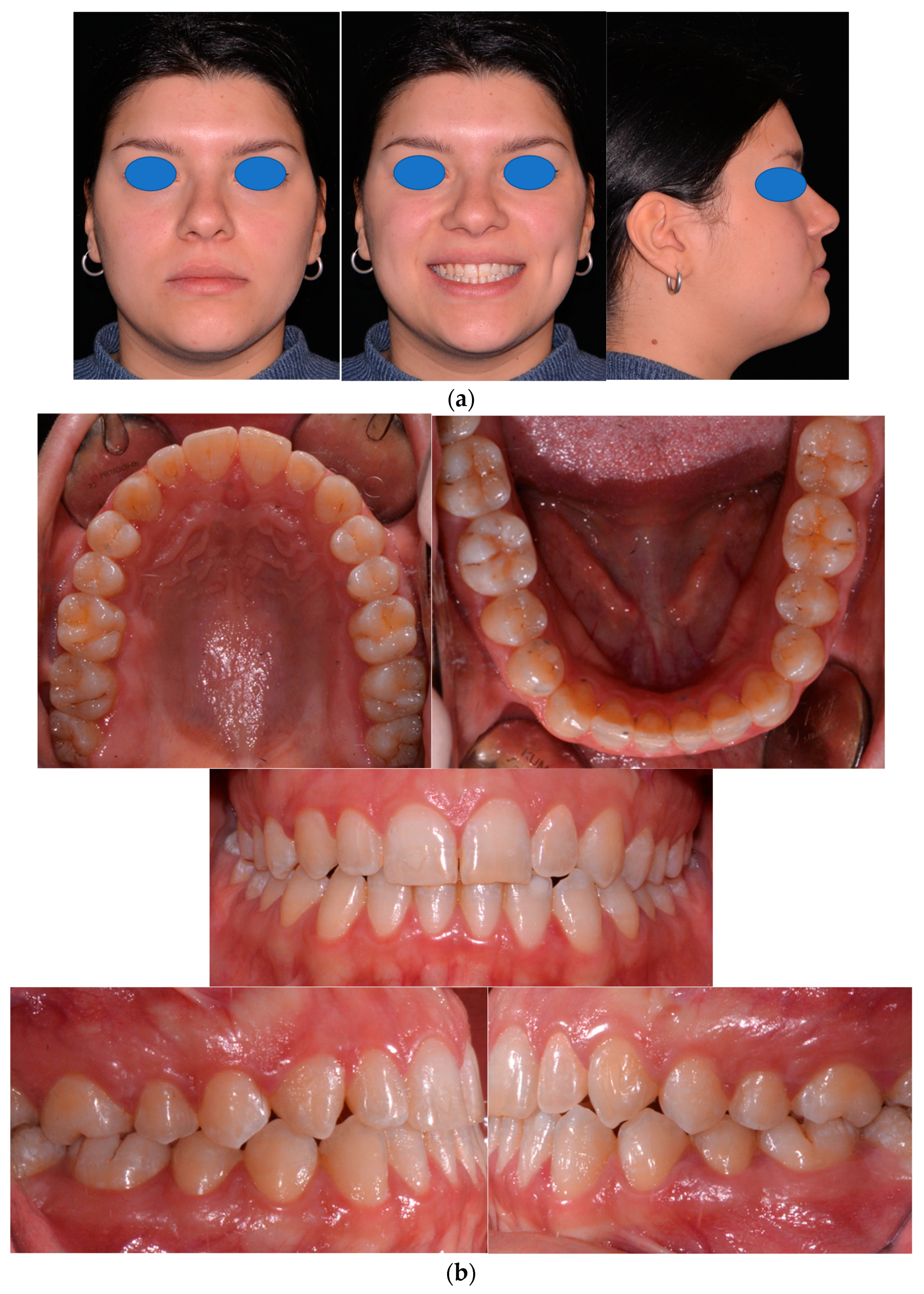 Applsci 14 02308 g011