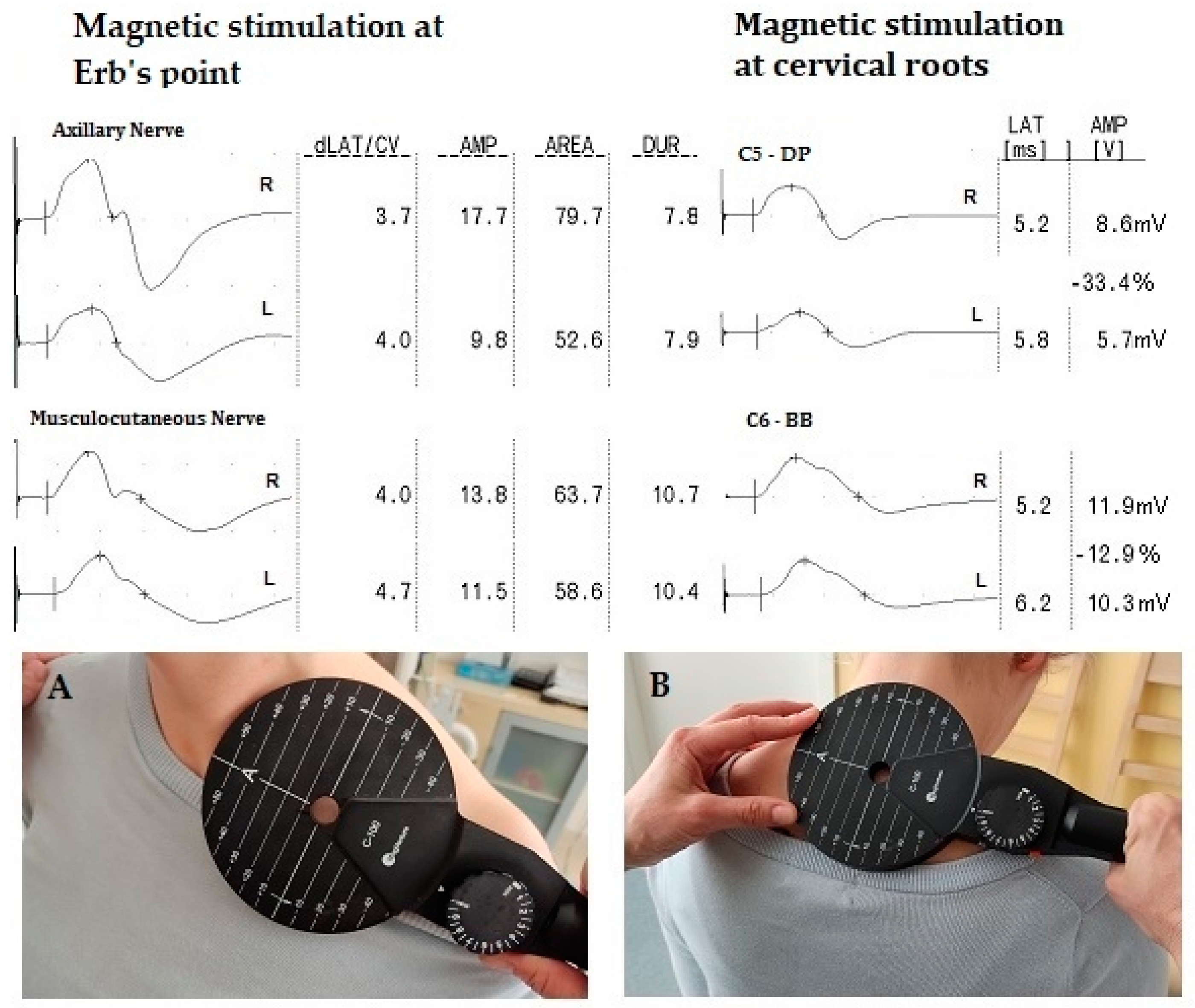 Applsci 14 02395 g001