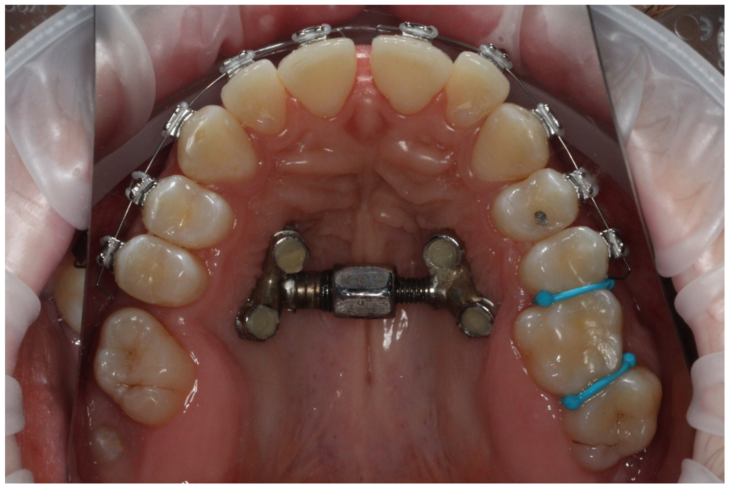 Applsci 14 02449 g003 Applsci 14 02449 g003