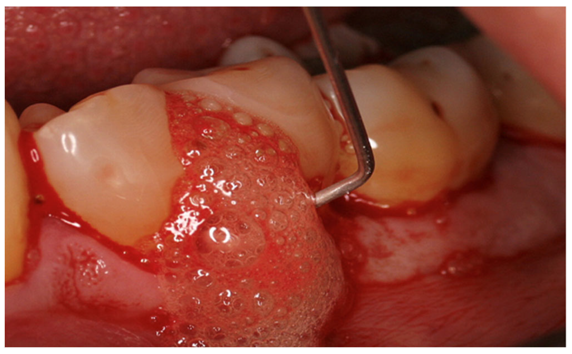 Applsci 14 02553 g005