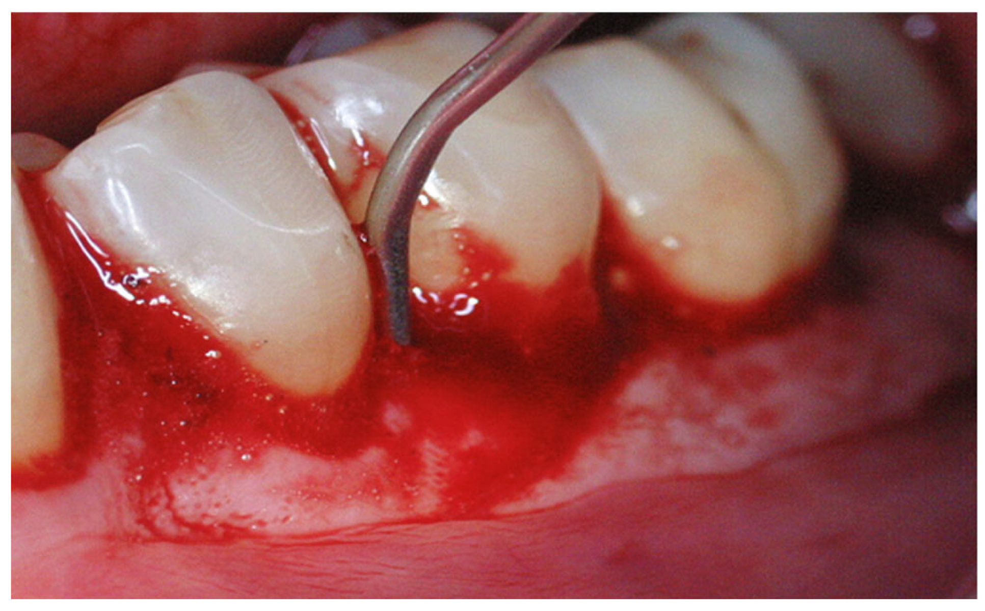 Applsci 14 02553 g006