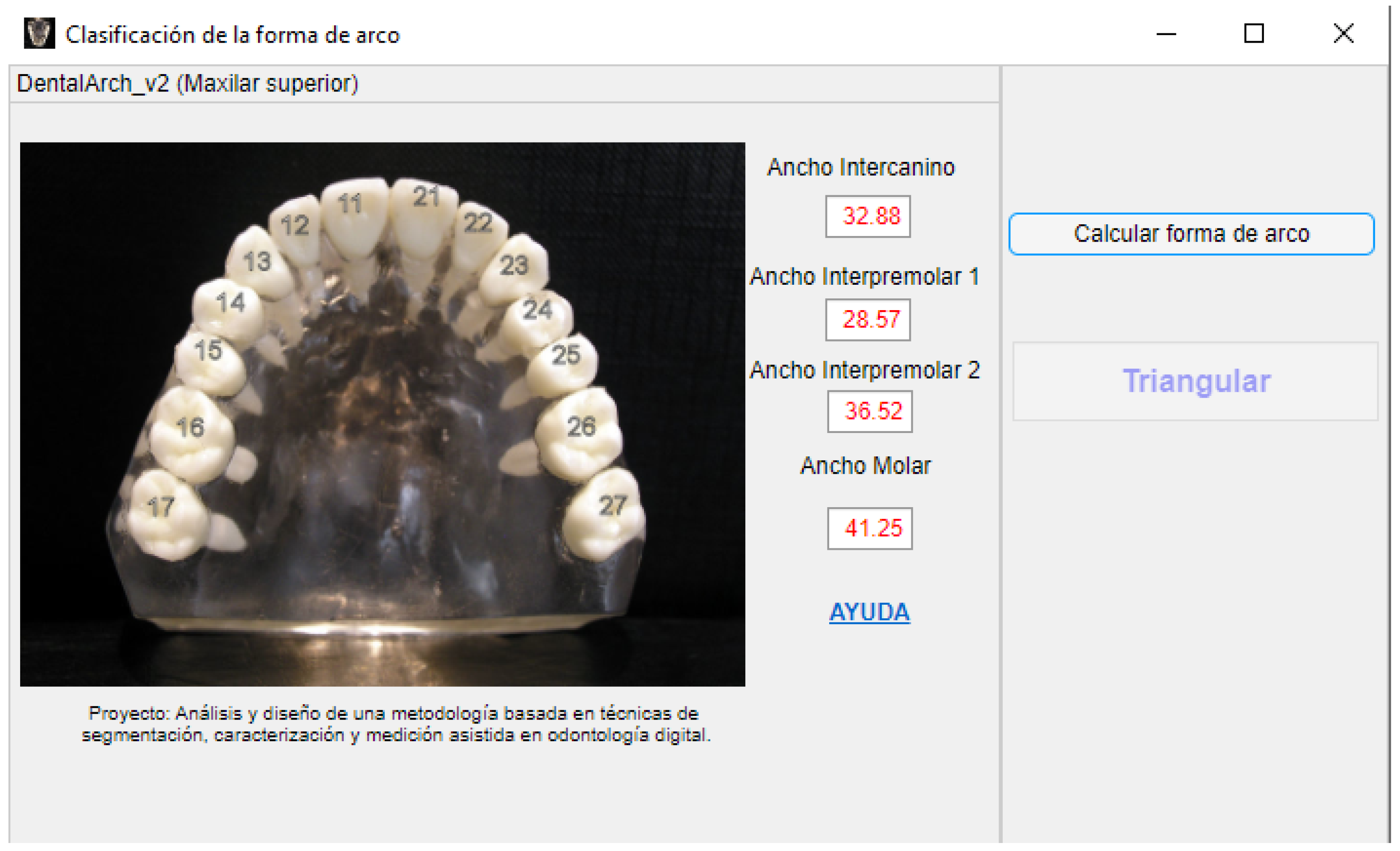 Applsci 14 02567 g006