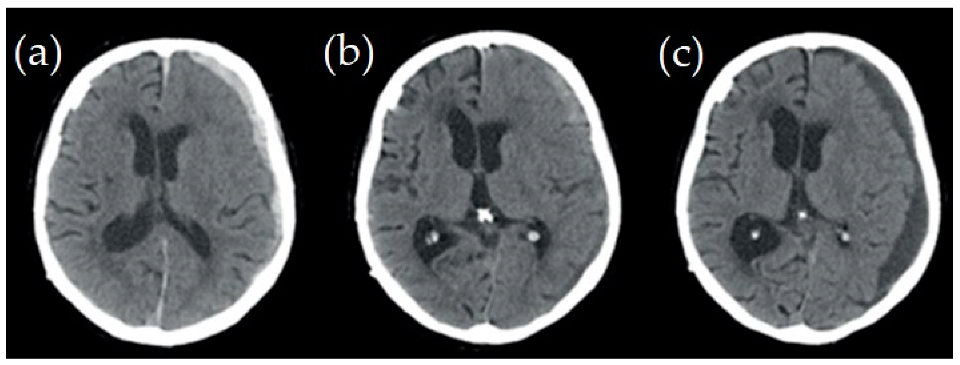 Applsci 14 02681 g002